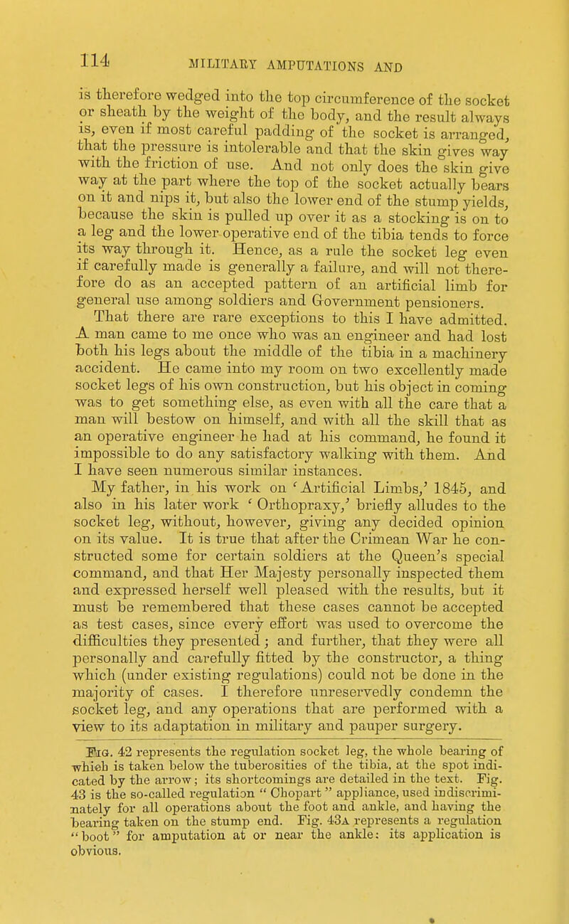 IS therefore wedged into tlie top circumference of tlie socket or slieath by the weight of the body, and the result always IS, even if most careful padding of the socket is arranged, that the pressure is intolerable and that the skin gives way with the friction of use. And not only does the skin give way at the part where the top of the socket actually bears on it and nips it, but also the lower end of the stump yields, because the skin is pulled up over it as a stocking is on to a leg and the lower operative end of the tibia tends to force its way through it. Hence, as a rule the socket leg even if carefully made is generally a failure, and will not there- fore do as an accepted pattern of an artificial limb for general use among soldiers and Grovernment pensioners. That there are rare exceptions to this I have admitted. A man came to me once who was an engineer and had lost both his legs about the middle of the tibia in a machinery accident. He came into my room on two excellently made socket legs of his own construction, but his object in coming was to get something else, as even with all the care that a man will bestow on himself, and with all the skill that as an operative engineer he had at his command, he found it impossible to do any satisfactory walking with them. And I have seen numerous similar instances. My father, in his work on ^Ai-tificial Limbs,' 1845, and also in his later work ' Orthopraxy,' briefly alludes to the socket leg, without, however, giving any decided opinion on its value. It is true that after the Crimean War he con- structed some for certain soldiers at the Queen's special command, and that Her Majesty personally inspected them and expressed herself well pleased -with the results, but it must be remembered that these cases cannot be accepted as test cases, since every effort was used to overcome the difficulties they presented; and further, that they were all personally and carefully fitted by the constructor, a thing which (under existing regulations) could not be done in the majority of cases. I therefore unreservedly condemn the socket leg, and any operations that are performed with a view to its adaptation in military and pauper surgery. Eiia. 42 represents the regulation socket leg, the whole bearing of whieh is taken below the tuberosities of the tibia, at the spot indi- cated by the arrow; its shortcomings are detailed in the text. Fig. 43 is the so-called regulation  Ohopart  appliance, used indiscrimi- nately for all operations about the foot and ankle, and having the bearing taken on the stump end. Fig. 43a represents a regulation boot for amputation at or near the ankle; its application is obvious.