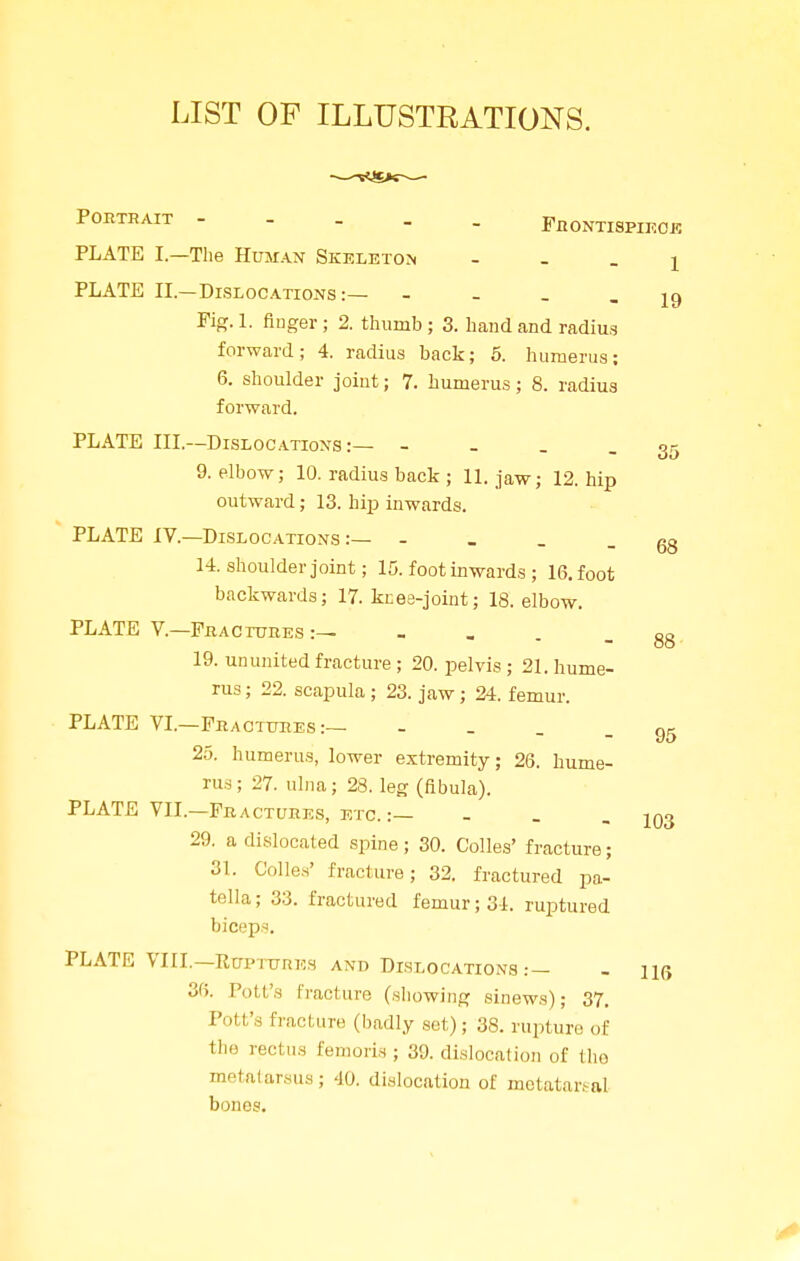 LIST OF ILLUSTRATIONS. 19 68 Portrait Frontispiece PLATE I—The Human Skeleton - - - 1 PLATE II.—Dislocations:— - Fig. 1. finger; 2. thumb ; 3. hand and radius forward; 4. radius back; 5. humerus; 6. shoulder joint; 7. humerus; 8. radius forward. PLATE III.—Dislocations:— - - - - 35 9. elbow; 10. radius back ; 11. jaw; 12. hip outward; 13. hip inwards. PLATE IV.—Dislocations :— - 14. shoulder joint; 15. foot inwards ; 16. foot backwards; 17. knee-joint; 18. elbow. PLATE V.—Fractures 19. ununited fracture ; 20. pelvis ; 21. hume- rus ; 22. scapula ; 23. jaw; 24. femur. PLATE VI.—Fractures:— - 25. humerus, lower extremity; 26. hume- rus; 27. ulna; 28. leg (fibula). PLATE VII.—Fractures, etc. :— - 29. a dislocated spine; 30. Colles' fracture; 31. Colles' fracture; 32. fractured pa- tella ; 33. fractured femur; 31. ruptured biceps. PLATE VIII.—Ruptures and Dislocations :— 36. Pott's fracture (showing sinews); 37. Pott's fracture (badly set); 38. rupture of the rectus femoris ; 39. dislocation of the metatarsus; -JO. dislocation of metatarsal bones. 95 103 116