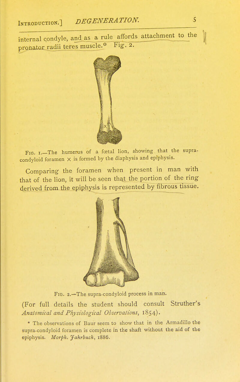 Introduction.] DEGENERATION. internal condyle, and_as a rule affords attochggnMofce pronatcjc.radnJer^sjnuscle/» Fig. 2. Fig. i The humerus of a foetal lion, showing that the supra- condyloid foramen X is formed by the diaphysis and epiphysis. Comparing the foramen when present in man with that of the lion, it will be seen that the portion of the ring derived from the epiphysis is represented by fibrous tissue. Fig. 2.—The supra-condyloid process in man. (For full details the student should consult Struther's Anatomical and Physiological Observations, 1854). * The observations of Baur seem to show that in the Armadillo the supra-condyloid foramen is complete in the shaft without the aid of the epiphysis. Morph. Jahrbuch, 1886.