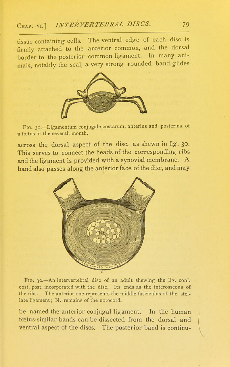 tissue containing- cells. The ventral edge of each disc is firmly attached to the anterior common, and the dorsal border to the posterior common ligament. In many ani- mals, notably the seal, a very strong rounded band glides Fig. 31.—Ligamentum conjugale costarum, anterius and posterius, of a foetus at the seventh month. across the dorsal aspect of the disc, as shewn in fig. 30. This serves to connect the heads of the corresponding ribs and the ligament is provided with a synovial membrane. A band also passes along the anterior face of the disc, and may Fig. 32.—An intervertebral disc of an adult shewing the lig. conj. cost. post, incorporated with the disc. Its ends as the interosseous of the ribs. The anterior one represents the middle fasciculus of the stel- late ligament; N. remains of the notocord. be named the anterior conjugal ligament. In the human foetus similar bands can be dissected from the dorsal and ventral aspect of the discs. The posterior band is continu-