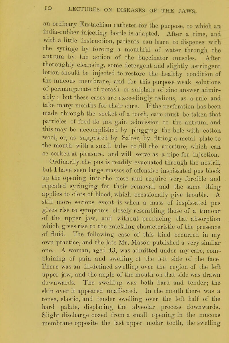lO an ordinary Eustachian catheter for the purpose, to which an india-rubber injecting bottle is adapted. After a time, and with a littJe instruction, patients can learn to dispense with the syringe by forcing a mouthful of water through the antrum by the action of the buqcinator muscles. After thoroughly cleansing, some detergent and slightly astringent lotion should be injected to restore the healthy condition of the raucous membrane, and for this purpose weak solutions of permanganate of potash or sulphate of zinc answer admir- ably ; but these cases are exceedingly tedious, as a rule and take many months for their cure. If the perforation has been made through the socket of a tooth, care must be taken that particles of food do not gain admission to the antrum, and this may be accomplished by plugging the hole with cotton wool, or, as suggested by Salter, by fitting a metal plate to the mouth with a small tube to fill the aperture, which can oe corked at pleasure, and will serve as a pipe for injection. Ordinarily.the pus is readily evacuated through the nostril, but I have seen large masses of offensive inspissated pus block up the opening into the nose and require very forcible and repeated syringing for their removal, and the same thing applies to clots of blood, which occasionally give trouble. A still more serious event is when a mass of inspissated pus gives rise to symptoms closely resembling those of a tumour of the upper jaw, and without producing that absorption which gives rise to the crackling characteristic of the presence of fluid. The following case of this kind occurred in my own practice, and the late Mr. Mason published a very similar one. A woman, aged 43, was admitted under my care, com- plaining of pain and swelling of the left side of the face There was an ill-defined swelling over the region of the left upper jaw, and the angle of the mouth on that side was drawn downwards. The swelling was both hard and tender; the skin over it appeared unaffected. In the mouth there was a tense, elastic, and tender swelling over the left half of the hard palate, displacing the alveolar process downwards. Slight discharge oozed from a small opening in the mucous membrane opposite the last upjaer molar tooth, the swelling