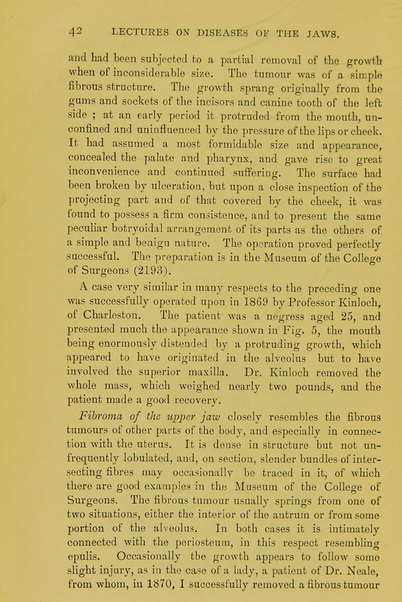 and had been subjected to a partial removal of the growth when of inconsiderable size. The tumour was of a simple fibrous structure. The growth sprang originally from the gums and sockets of the incisors and canine tooth of the left side ; at an early period it protruded from the mouth, un- confined and uninfluenced by the pressure of the lips or cheek. It had assumed a most formidable size and appearance, concealed the palate and pharynx, and gave rise to great inconvenience and continued suffering. The surface had been broken by ulceration, but upon a close inspection of the projecting part and of that covered by the cheek, it was found to possess a firm consistence, and to present the same peculiar botryoidal arrangement of its parts as the others of a simple and benign nature. The operation proved perfectly successful. The preparation is in the Museum of the College of Surgeons (2193). A case very similar in many respects to the preceding one was successfully operated upon in 1869 by Professor Kinloch, of Charleston. The patient was a negress aged 25, and presented much the appearance shown in Fig. 5, the mouth being enormously distended by a protruding growth, which appeared to have originated in the alveolus but to have involved the superior maxilla. Dr. Kinloch removed the whole mass, which weighed nearly two pounds, and the patient made a good recovery. Fibroma of the iipper jaw closely resembles the fibrous tumours of other parts of the body, and especially in connec- tion with the uterus. It is dense in structure but not un- frequently lobulated, and, on section, slender bundles of inter- secting fibres may occasionally be traced in it, of which there are good examples in the Museum of the College of Surgeons. The fibrous tumour usually springs from one of two situations, either the interior of the antrum or from some portion of the alveolus. In both cases it is intimately connected with the periosteum, in this respect resembling epulis. Occasionally the growth appears to follow some slight injury, as in the case of a lady, a patient of Dr. Neale, from whom, in 1870, I successfully removed a fibrous tumour