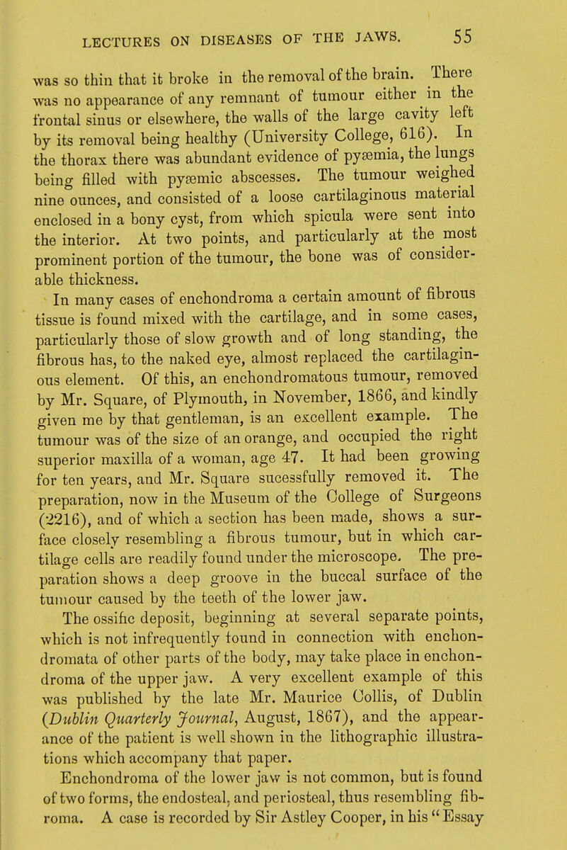 was so thin that it broke in the removal of the brain. There was no appearance of any remnant of tumour either in the frontal sinus or elsewhere, the walls of the large cavity left by its removal being healthy (University College, 616). In the thorax there was abundant evidence of pyaemia, the lungs being filled with pya3mic abscesses. The tumour weighed nine ounces, and consisted of a loose cartilaginous material enclosed in a bony cyst, from which spicula were sent into the interior. At two points, and particularly at the most prominent portion of the tumour, the bone was of consider- able thickness. In many cases of enchondroma a certain amount of fibrous tissue is found mixed with the cartilage, and in some cases, particularly those of slow growth and of long standing, the fibrous has, to the naked eye, almost replaced the cartilagin- ous element. Of this, an enchondromatous tumour, rernoved by Mr. Square, of Plymouth, in November, 1866, and kindly given me by that gentleman, is an excellent example. The tumour was of the size of an orange, and occupied the right superior maxilla of a woman, age 47. It had been growing for ten years, and Mr. Square sucessfully removed it. The preparation, now in the Museum of the College of Surgeons (2216), and of which a section has been made, shows a sur- face closely resembling a fibrous tumour, but in which car- tilage cells are readily found under the microscope. The pre- paration shows a deep groove in the buccal surface of the tumour caused by the teeth of the lower jaw. The ossific deposit, beginning at several separate points, which is not infrequently found in connection with euchon- dromata of other parts of the body, may take place in enchon- droma of the upper jaw. A very excellent example of this was published by the late Mr. Maurice Collis, of Dublin (Dublin Quarterly Journal, August, 1867), and the appear- ance of the patient is well shown in the lithographic illustra- tions which accompany that paper. Enchondroma of the lower jaw is not common, but is found of two forms, the endosteal, and periosteal, thus resembling fib- roma. A case is recorded by Sir Astley Cooper, in his  Essay