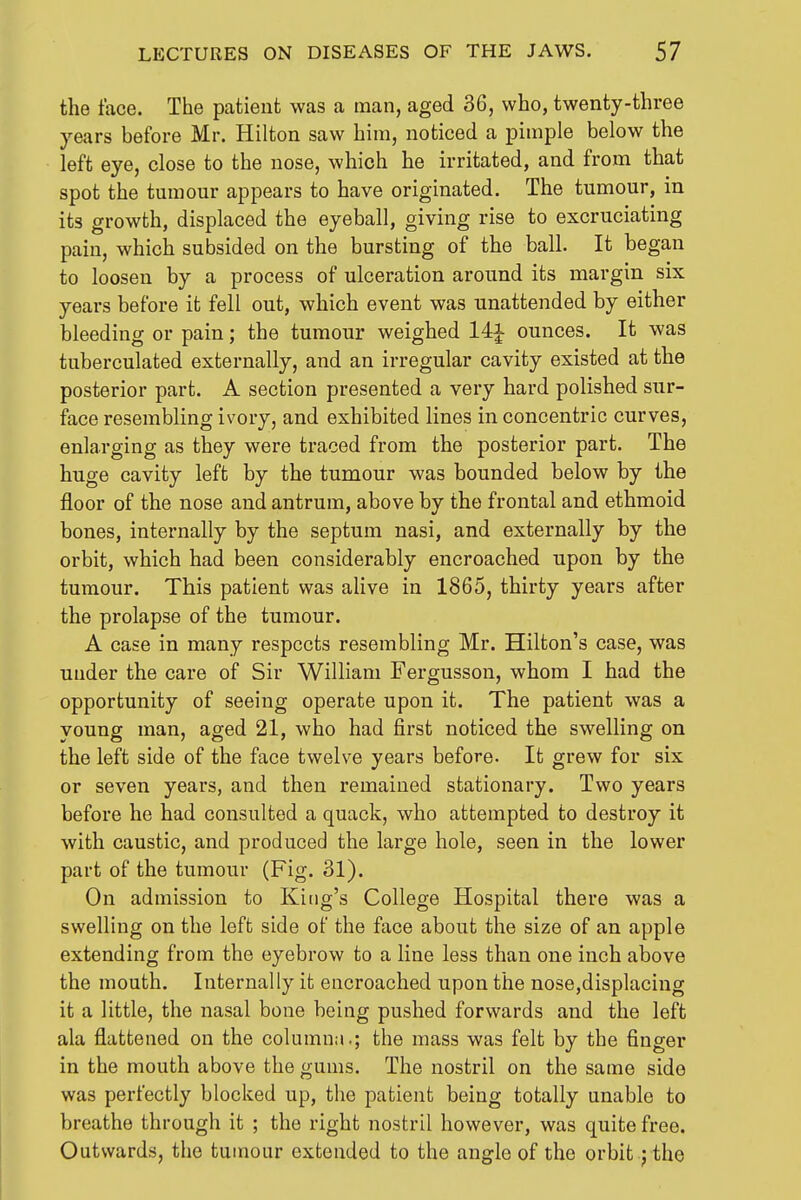 the face. The patient was a man, aged 36, who, twenty-three years before Mr. Hilton saw him, noticed a pimple below the left eye, close to the nose, which he irritated, and from that spot the tumour appears to have originated. The tumour, in its growth, displaced the eyeball, giving rise to excruciating pain, which subsided on the bursting of the ball. It began to loosen by a process of ulceration around its margin six years before it fell out, which event was unattended by either bleeding or pain; the tumour weighed 14i ounces. It was tuberculated externally, and an irregular cavity existed at the posterior part. A section presented a very hard polished sur- face resembling ivory, and exhibited lines in concentric curves, enlarging as they were traced from the posterior part. The huge cavity left by the tumour was bounded below by the floor of the nose and antrum, above by the frontal and ethmoid bones, internally by the septum nasi, and externally by the orbit, which had been considerably encroached npon by the tumour. This patient was alive in 1865, thirty years after the prolapse of the tumour. A case in many respects resembling Mr. Hilton's case, was under the care of Sir William Fergusson, whom I had the opportunity of seeing operate upon it. The patient was a young man, aged 21, who had first noticed the swelling on the left side of the face twelve years before. It grew for six or seven years, and then remained stationary. Two years before he had consulted a quack, who attempted to destroy it with caustic, and produced the large hole, seen in the lower part of the tumour (Fig. 31). On admission to King's College Hospital there was a swelling on the left side of the face about the size of an apple extending from the eyebrow to a line less than one inch above the mouth. Internally it encroached upon the nose,displacing it a little, the nasal bone being pushed forwards and the left ala flattened on the columna.; the mass was felt by the finger in the mouth above the gums. The nostril on the same side was perfectly blocked up, the patient being totally unable to breathe through it ; the right nostril however, was quite free. Outwards, the tumour extended to the angle of the orbit j the