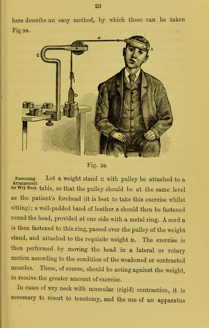 here describe an easy method, by which these can be taken Fig 38. Fig. 38. Exercising Let a weight stand c with pulley be attached to a Arrangement for wry Neck, table, so that the pulley should be at the same level as the patient's forehead (it is best to take this exercise whilst sitting); a well-padded band of leather a should then be fastened round the head, provided at one side with a metal ring. A cord b is then fastened to this ring, passed over the pulley of the weight stand, and attached to the requisite weight d. The exercise is then performed by moving the head in a lateral or rotary motion according to the condition of the weakened or contracted muscles. These, of course, should be acting against the weight, to receive the greater amount of exercise. In cases of wry neck with muscular (rigid) contraction, it is necessary to resort to tenotomy, and the use of an apparatus