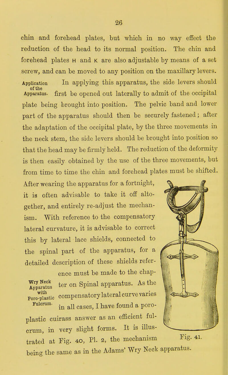 chin and forehead plates, but which in no way effect the reduction of the head to its normal position. The chin and forehead plates h and k are also adjustable by means of a set screw, and can be moved to any position on the maxillary levers. Application In applying this apparatus, the side levers should of the . . . Apparatus, first be opened out laterally to admit of the occipital plate being brought into position. The pelvic band and lower part of the apparatus should then be securely fastened; after the adaptation of the occipital plate, by the three movements in the neck stem, the side levers should be brought into position so that the head may be firmly held. The reduction of the deformity is then easily obtained by the use of the three movements, but from time to time the chin and forehead plates must be shifted. After wearing the apparatus for a fortnight, it is often advisable to take it off alto- gether, and entirely re-adjust the mechan- ism. With reference to the compensatory lateral curvature, it is advisable to correct this by lateral lace shields, connected to the spinal part of the apparatus, for a detailed description of these shields refer- ence must be made to the chap- SJaSt™ ter on Spinal apparatus. As the Pontic compensatorylateralcurvevaries Fulcrum. ^ ^ j have found a poro. plastic cuirass answer as an efficient ful- crum, in very slight forms. It is illus- trated at Fig. 40, PL 2, the mechanism being the same as in the Adams' Wry Neck apparatus. Fig. 41.