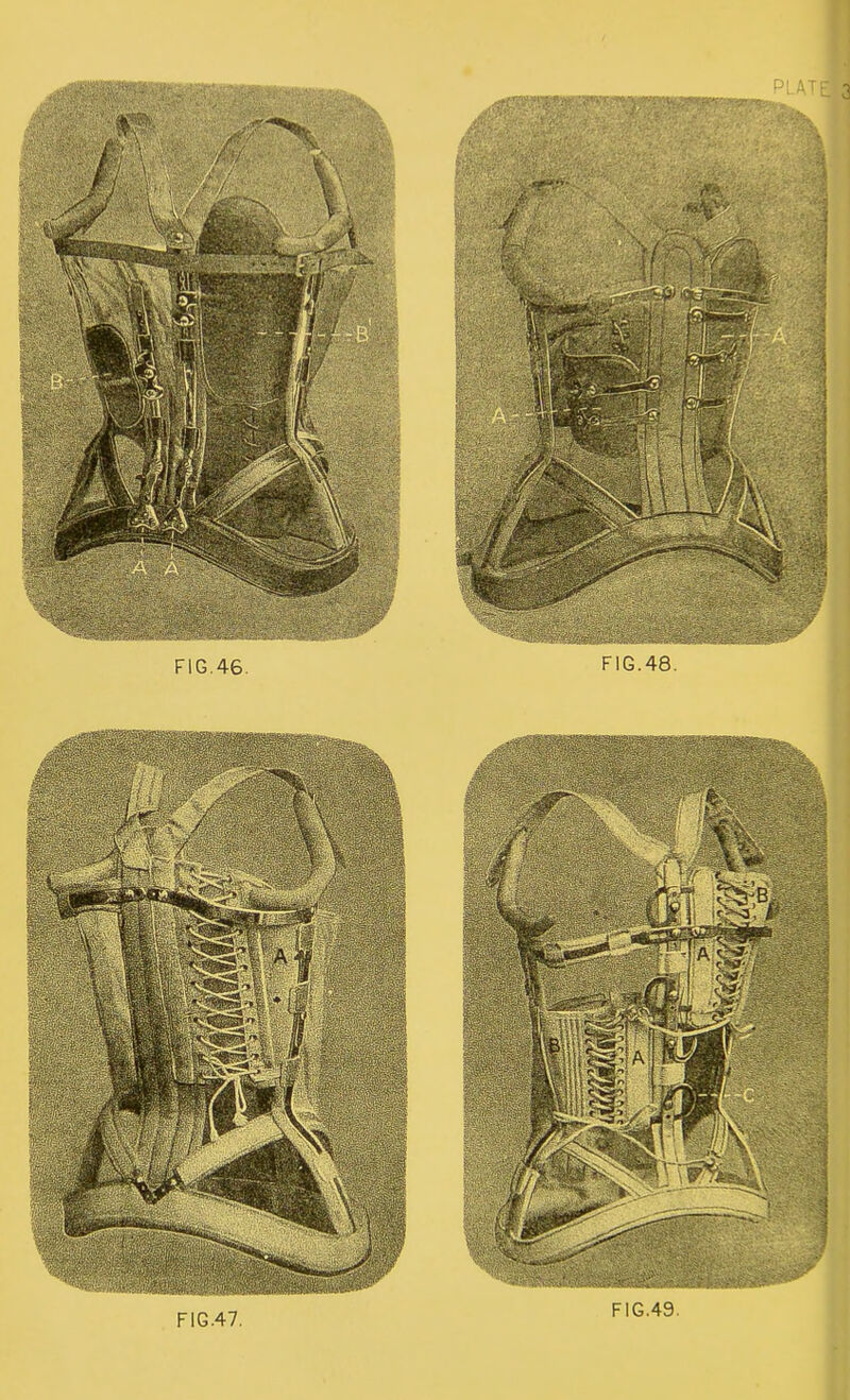 FIG.46. FIG.48. FIG.47. FIG.49