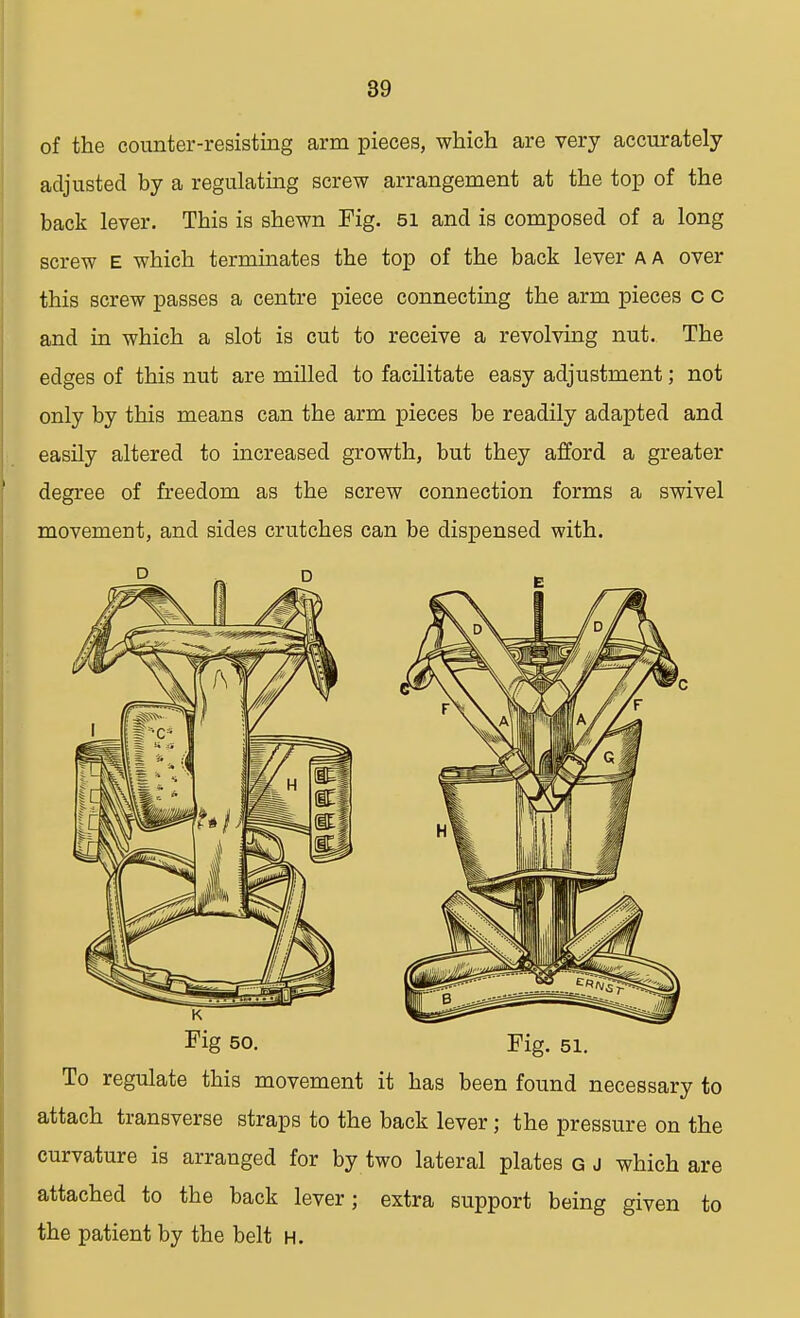 of the counter-resisting arm pieces, which are very accurately adjusted by a regulating screw arrangement at the top of the back lever. This is shewn Fig. 51 and is composed of a long screw E which terminates the top of the back lever a a over this screw passes a centre piece connecting the arm pieces c c and in which a slot is cut to receive a revolving nut. The edges of this nut are milled to facilitate easy adjustment; not only by this means can the arm pieces be readily adapted and easily altered to increased growth, but they afford a greater degree of freedom as the screw connection forms a swivel movement, and sides crutches can be dispensed with. Fig 50. Fig. 51. To regulate this movement it has been found necessary to attach transverse straps to the back lever; the pressure on the curvature is arranged for by two lateral plates g j which are attached to the back lever; extra support being given to the patient by the belt h.