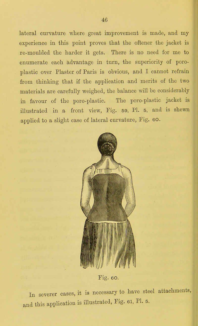 lateral curvature where great improvement is made, and my experience in this point proves that the oftener the jacket is re-moulded the harder it gets. There is no need for me to enumerate each advantage in turn, the superiority of poro- plastic over Plaster of Paris is ohvious, and I cannot refrain from thinking that if the application and merits of the two materials are carefully weighed, the balance will be considerably in favour of the poro-plastic. The poro-plastic jacket is illustrated in a front view, Fig. 59, PI. 5, and is shewn applied to a slight case of lateral curvature, Fig. 60. Fig. 60. In severer cases, it is necessary to have steel attachments, and this application is illustrated, Fig. ei, PL 5.