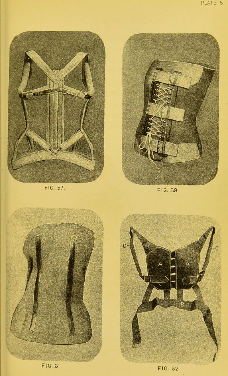 FIG. 57. FIG. 59. I f FIG. 61. FIG. 62.