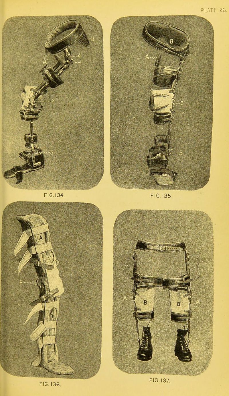 No text description is available for this image