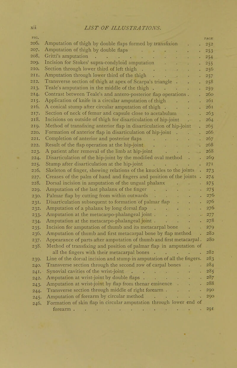 f'f^. I'AOE 206. Amputation of thigh by double flaps formed by transfixion . . 252 207. Amputation of thigh by double flaps 253 208. Gritti's amputation 254 209. Incision for Stokes' supra-condyloid amputation .... 255 210. Section through lower third of left thigh 256 211. Amputation through lower third of the thigh 257 212. Transverse section of thigh at apex of Scarpa's triangle . . . 258 213. Teale's amputation in the middle of the thigh 259 214. Contrast between Teale's and antero-posterior flap operations . . 260 215. Application of knife in a circular amputation of thigh . . . 261 216. A conical stump after circular amputation of thigh .... 261 217. Section of neck of femur and capsule close to acetabulum . . 263 218. Incisions on outside of thigh for disarticulation of hip-joint . . 264 219. Method of transfixing anterior flap in disarticulation of hip-joint . 265 220. Formation of anterior flap in disarticulation of hip-joint . . . 266 221. Completion of anterior and posterior flaps 267 222. Result of the flap operation at the hip-joint 268 223. A patient after removal of the limb at hip-joint .... 268 224. Disarticulation of the hip-joint by the modified oval method . . 269 225. Stump after disarticulation at the hip-joint 271 226. Skeleton of finger, showing relations of the knuckles to the joints . 273 227. Creases of the palm of hand and fingers and position of the joints . 274 228. Dorsal incision in amputation of the ungual phalanx . . . 275 229. Amputation of the last phalanx of the finger 275 230. Palmar flap by cutting from within outwards 276 231. Disarticulation subsequent to formation of palmar flap . . . 276 232. Amputation of a phalanx by long dorsal flap 276 233. Amputation at the metacarpo-phalangeal joint 277 234. Amputation at the metacarpo-phalangeal joint 278 235. Incision for amputation of thumb and its metacarpal bone . . 279 236. Amputation of thumb and first metacarpal bone by flap method . 280 237. Appearance of parts after amputation of thumb and first metacarpal. 280 238. Method of transfixing and position of palmar flap in amputation of all the fingers with their metacarpal bones 282 239. Line of the dorsal incision and stump in amputation of all the fingers. 283 240. Transverse section through the second row of carpal bones . . 284 241. Synovial cavities of the wrist-joint ....... 285 242. Amputation at wrist-joint by double flaps 287 243. Amputation at wrist-joint by flap froni thenar eminence . . . 288 244. Transverse section through middle of right forearm . . . • 290 245. Amputation of forearm by circular method 290 246. Formation of skin flap in circular amputation through lower end of forearm 291