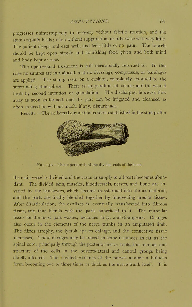 progresses uninterruptedly to recovery without febrile reaction, and the stump rapidly heals; often without suppuration, or otherwise with very little. The patient sleeps and eats well, and feels little or no pain. The bowels should be kept open, simple and nourishing food given, and both mind and body kept at ease. The open-wound treatment is still occasionally resorted to. In this case no sutures are introduced, and no dressings, compresses, or bandages are applied. The stump rests on a cushion, completely exposed to the surrounding atmosphere. There is suppuration, of course, and the wound heals by second intention or granulation. The discharges, however, flow away as soon as formed, and the part can be irrigated and cleansed as often as need be without much, if any, disturbance. Results —The collateral circulation is soon established in the stump after Fig. 131.—Plastic periostitis of the divided ends of the bone. the main vessel is divided and the vascular supply to all parts becomes abun- dant. The divided skin, muscles, bloodvessels, nerves, and bone are in- vaded by the leucocytes, which become transformed into fibrous material, and the parts are finally blended together by intervening areolar tissue. After disarticulation, the cartilage is eventually transformed into fibrous tissue, and thus blends with the parts superficial to it. The muscular tissue for the most part wastes, becomes fatty, and disappears. Changes also occur in the elements of the nerve trunks in an amputated limb. The fibres atrophy, the lymph spaces enlarge, and the connective tissue increases. These changes may be traced in some instances as far as the spinal cord, principally through the posterior nerve roots, the number and structure of the cells in the postero-lateral and central groups being chiefly affected. The divided extremity of the nerves assume a bulbous form, becoming two or three times as thick as the nerve trunk itself This