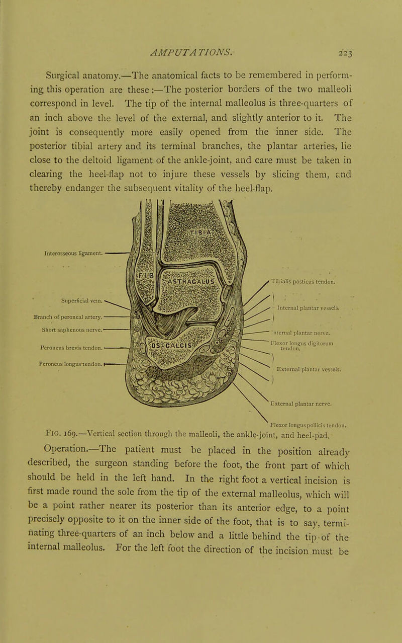 Surgical anatomy.—The anatomical facts to be remembered in perform- ing this operation are these:—The posterior borders of the two malleoli correspond in level. The tip of the internal malleolus is three-quarters of an inch above the level of the external, and slightly anterior to it. The joint is consequently more easily opened from the inner side. The posterior tibial artery and its terminal branches, the plantar arteries, lie close to the deltoid ligament of the ankle-joint, and care must be taken in clearing the heel-flap not to injure these vessels by slicing them, end thereby endanger the subsequent vitality of the heel-flap. Flexor longuspollicis tonclcm. Fig. 169.—Vertical section through the malleoli, the ankle-joint, and heel-pad. Operation.—The patient must be placed in the position already described, the surgeon standing before the foot, the front part of which should be held in the left hand. In the right foot a vertical incision is first made round the sole from the tip of the external malleolus, which will be a point rather nearer its posterior than its anterior edge, to a point precisely opposite to it on the inner side of the foot, that is to say, termi- nating three-quarters of an inch below and a little behind the tip-of the internal malleolus. For the left foot the direction of the incision must be