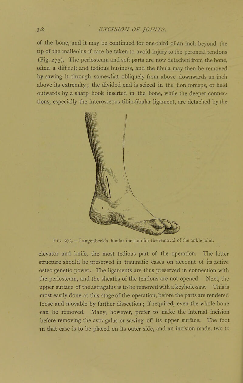 of the bone, and it may be continued for one-third of an inch beyond the tip of the malleolus if care be taken to avoid injury to the peroneal tendons (Fig. 273). The periosteum and soft parts are now detached from the bone, often a difficult and tedious business, and the fibula may then be removed by sawing it through somewhat obliquely from above downwards an inch above its extremity; the divided end is seized in the lion forceps, or held outwards by a sharp hook inserted in the bone, while the deeper connec- tions, especially the interosseous tibio-fibular ligament, are detached by the Fig. 273.—Langenbeck's fibular incision for tlie removal of the ankle-joint. ■elevator and knife, the most tedious part of the operation. The latter structure should be preserved in traumatic cases on account of its active osteo-genetic power. The ligaments are thus preserved in connection with the periosteum, and the sheaths of the tendons are not opened. Next, the upper surface of the astragalus is to be removed with a keyhole-saw. This is most easily done at this stage of the operation, before the parts are rendered loose and movable by further dissection; if required, even the whole bone •can be removed. Many, however, prefer to make the internal incision before removing the astragalus or sawing off its upper surface. The foot in that case is to be placed on its outer side, and an incision made, two to