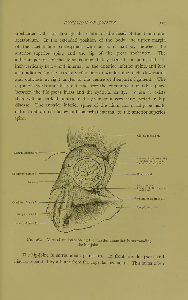 trochanter will pass through the centre of the head of the femur and acetabulum. In the extended position of the body, the upper margin of the acetabulum corresponds with a point half-way between the anterior superior spine and the tip of the great trochanter. The anterior portion of the joint is immediately beneath a point half an inch vertically below and internal to the anterior inferior spine, and it is also indicated by the extremity of a line drawn for one inch downwards and outwards at right angles to the centre of Poupart's ligament. The capsule is weakest at this point, and here the communication takes place between the ilio-psoas bursa and the synovial cavity. Where it exists there will be marked fulness in the groin at a very early period in hip disease. The anterior inferior spine of the ilium can usually be made out in front, an inch below and somewhat internal to the anterior superior spine. Gluteus minimus M. Obturator internus M Capsule. Quadratus femoris M. Biceps femoris M. Scmi-tendinosus M. Gluteus mediu.s M. Section of capsule rnd ilio-fenioral ]ii»ainent. Tendon of llie rectus. llio-psoas ^r. Psoas tentlon. Section of the capsule and bursa. • Obturator cjttenius M. Symphysis pubis. Fig. 282.—Verlical section showing tlie muscles immediately surrounding the hip-joint. The hip-joint is surrounded by muscles. In front are the psoas and iliacus, separated by a bursa from the capsular ligament. This bursa often