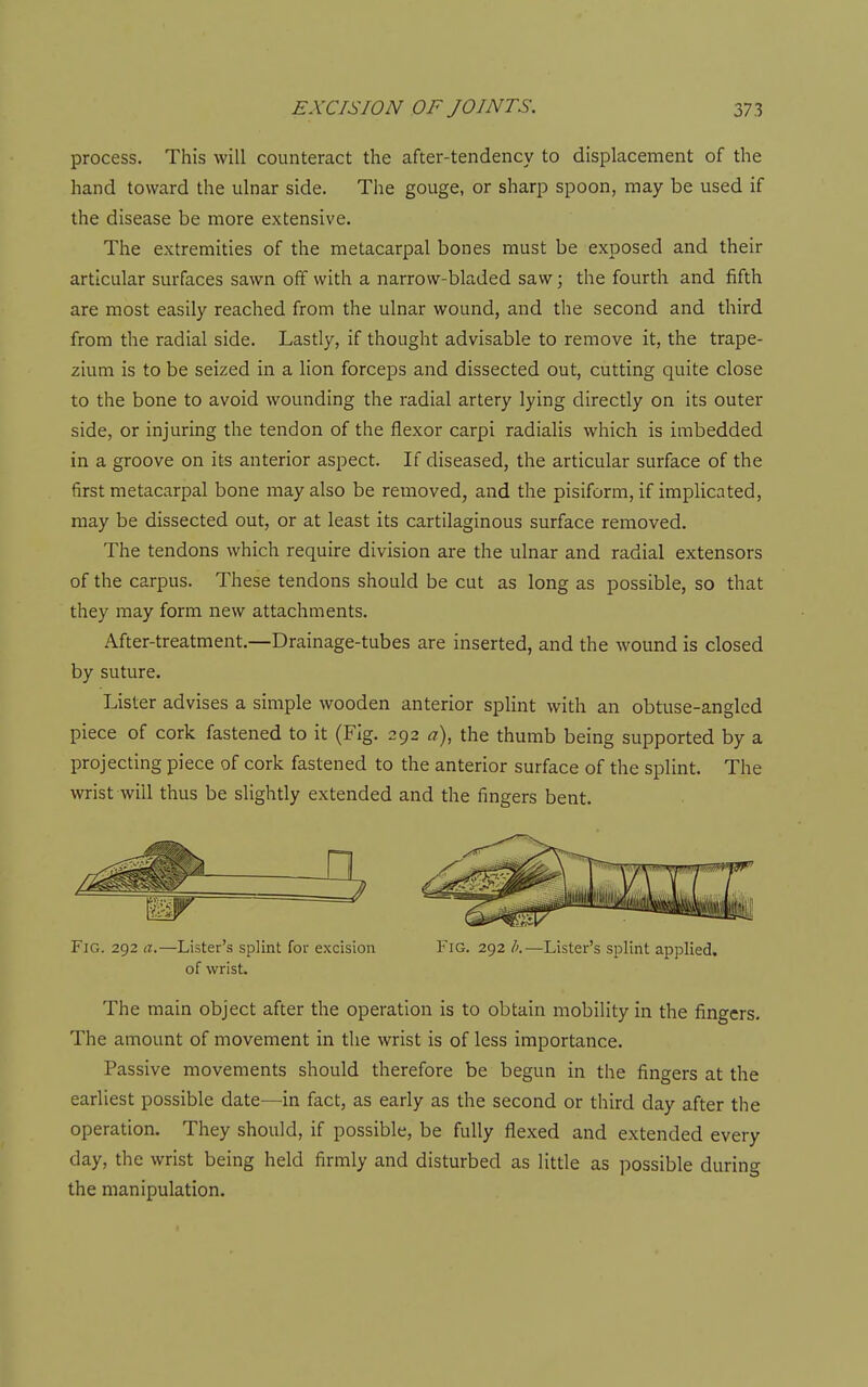 process. This will counteract the after-tendency to displacement of the hand toward the ulnar side. The gouge, or sharp spoon, may be used if the disease be more extensive. The extremities of the metacarpal bones must be exposed and their articular surfaces sawn off with a narrow-bladed saw; the fourth and fifth are most easily reached from the ulnar wound, and the second and third from the radial side. Lastly, if thought advisable to remove it, the trape- zium is to be seized in a lion forceps and dissected out, cutting quite close to the bone to avoid wounding the radial artery lying directly on its outer side, or injuring the tendon of the flexor carpi radialis which is imbedded in a groove on its anterior aspect. If diseased, the articular surface of the first metacarpal bone may also be removed, and the pisiform, if implicated, may be dissected out, or at least its cartilaginous surface removed. The tendons which require division are the ulnar and radial extensors of the carpus. These tendons should be cut as long as possible, so that they may form new attachments. After-treatment.—Drainage-tubes are inserted, and the wound is closed by suture. Lister advises a simple wooden anterior splint with an obtuse-angled piece of cork fastened to it (Fig. 292 «), the thumb being supported by a projecting piece of cork fastened to the anterior surface of the splint. The wrist will thus be slightly extended and the fingers bent. Fig. 292 a.—Lister's splint for excision of wrist Fig. 292 —Lister's splint applied. The main object after the operation is to obtain mobility in the fingers. The amount of movement in the wrist is of less importance. Passive movements should therefore be begun in the fingers at the earliest possible date—in fact, as early as the second or third day after the operation. They should, if possible, be fully flexed and extended every day, the wrist being held firmly and disturbed as little as possible during the manipulation.