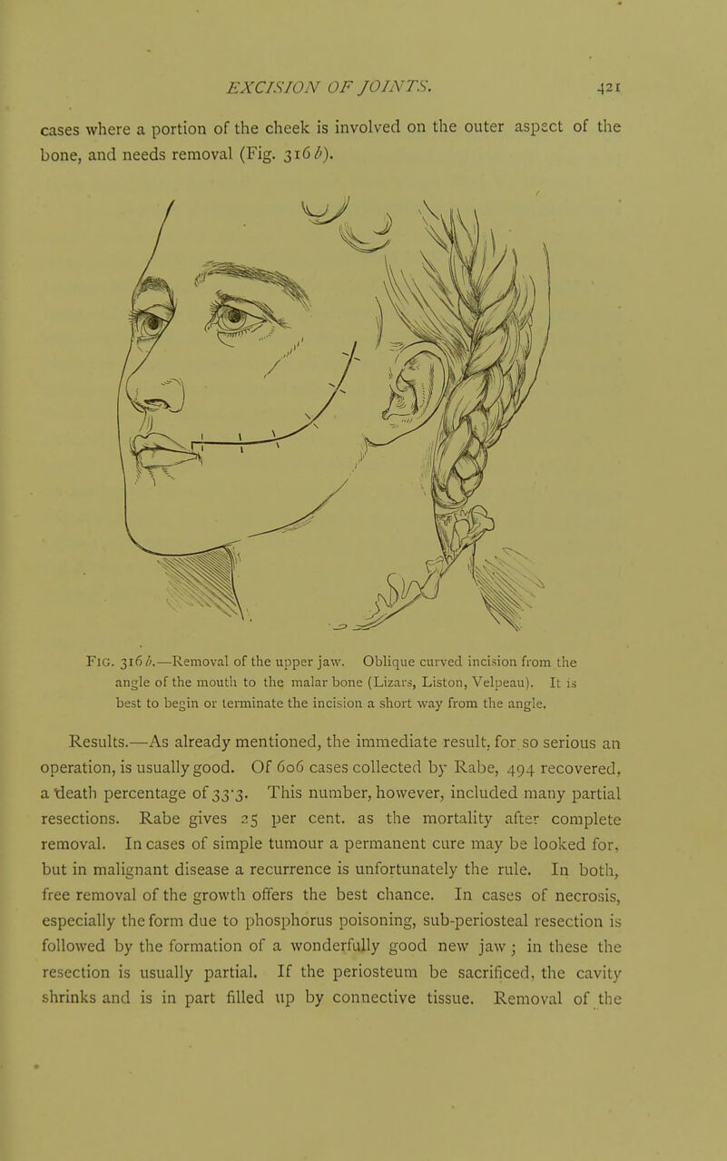 cases where a portion of the cheek is involved on the outer aspect of the bone, and needs removal (Fig. 3i6<!'). Fig. 316/a—Removal of the upper jaw. Oblique cuived incision from tlie angle of the mouth to the malar bone (Lizars, Listen, Velpeau). It is best to begin or terminate the incision a short way from the angle. Results.—As already mentioned, the immediate result, for so serious an operation, is usually good. Of 606 cases collected by Rabe, 494 recovered, aideath percentage of 33'3. This number, however, included many partial resections. Rabe gives 25 per cent, as the mortality after complete removal. In cases of simple tumour a permanent cure may be looked for, but in malignant disease a recurrence is unfortunately the rule. In both, free removal of the growth offers the best chance. In cases of necrosis, especially the form due to phosphorus poisoning, sub-periosteal resection is followed by the formation of a wonderfully good new jaw 3 in these the resection is usually partial. If the periosteum be sacrificed, the cavity shrinks and is in part filled up by connective tissue. Removal of the