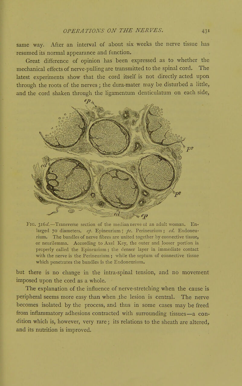 same way. After an interval of about six weeks the nerve tissue has resumed its normal appearance and function. Great difference of opinion has been expressed as to whether the mechanical effects of nerve-pulling are transmitted to the spinal cord. The latest experiments show that the cord itself is not directly acted upon through the roots of the nerves ; the dura-mater may be disturbed a litde, and the cord shaken through the ligamentum denticulatum on each side^ Fig. 316^/.—Transverse section of tlie median nerve of an adult woman. En- larged 70 diameters, ep. Epineurium; pe. Perineurium; ed. Endoneu- rium. The bundles of nerve fibres are united together by connective tissue, or neurilemma. According to Axel Key, the outer and looser portion is properly called the Epineurium; the denser layer in immediate contact with the nerve is the Perineurium; while the septum of connective tissue which penetrates the bundles is the Endoneurium. but there is no change in the intra-spinal tension, and no movement imposed upon the cord as a whole. The explanation of the influence of nerve-stretching when the cause is peripheral seems more easy than when ..the lesion is central. The nerve becomes isolated by the process, and thus in some cases may be freed from inflammatory adhesions contracted with surrounding tissues—a con- dition which is, however, very rare; its relations to the sheath are altered, and its nutrition is improved.