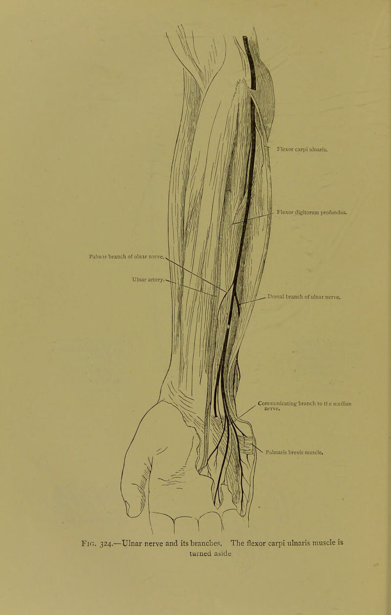 Fir,. 324.—Ulnar nerve and its brandies. The flexor carpi ulnaris muscle is turned abide