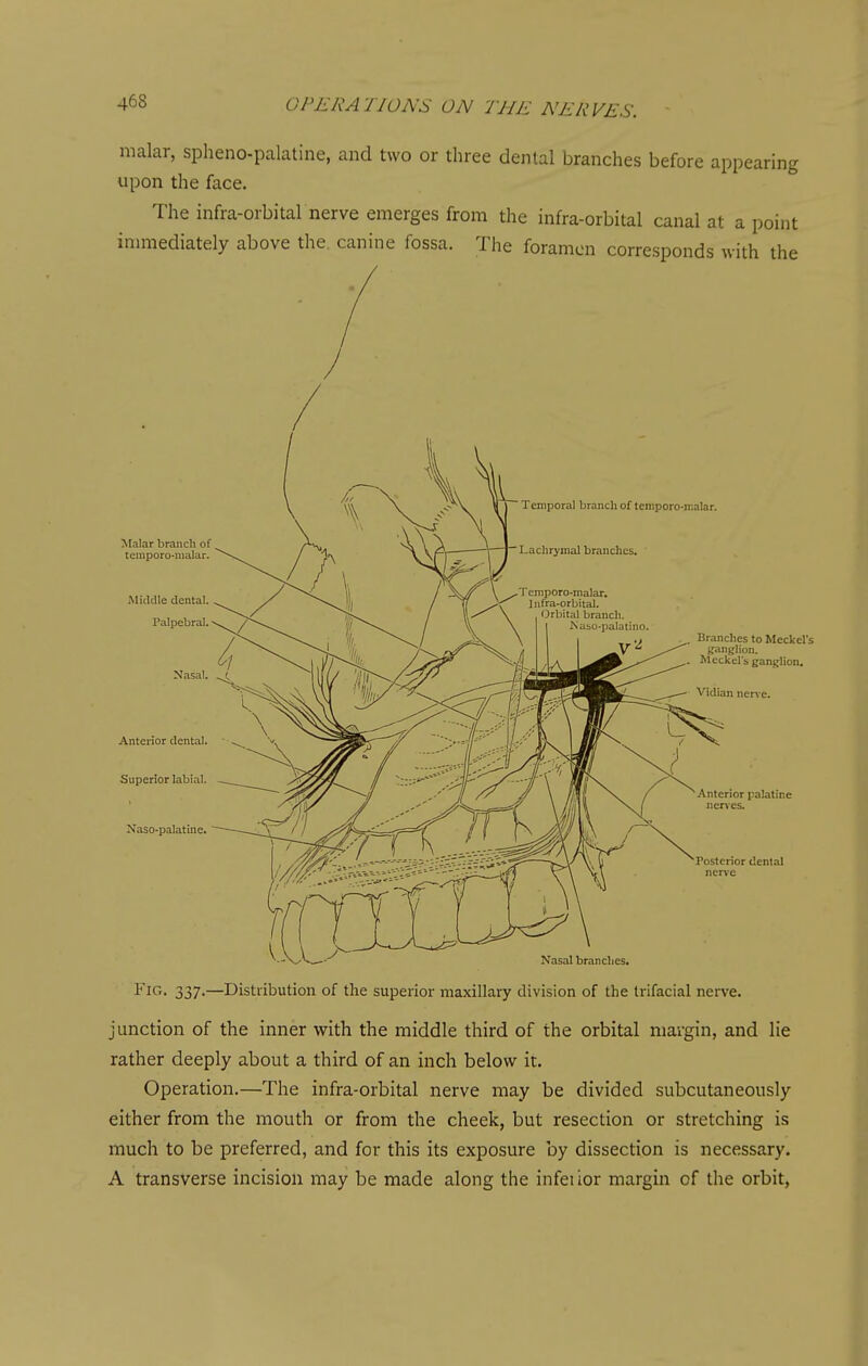 malar, spheno-palatine, and two or three dental branches before appearing upon the face. The infra-orbital nerve emerges from the infra-orbital canal at a point innnediately above the, canine fossa. The foramen corresponds with the Fif'- 337-—Distribution of the superior maxillary division of the trifacial nerve. junction of the inner with the middle third of the orbital margin, and lie rather deeply about a third of an inch below it. Operation.—The infra-orbital nerve may be divided subcutaneously either from the mouth or from the cheek, but resection or stretching is much to be preferred, and for this its exposure by dissection is necessary. A transverse incision may be made along the infei ior margin of the orbit,