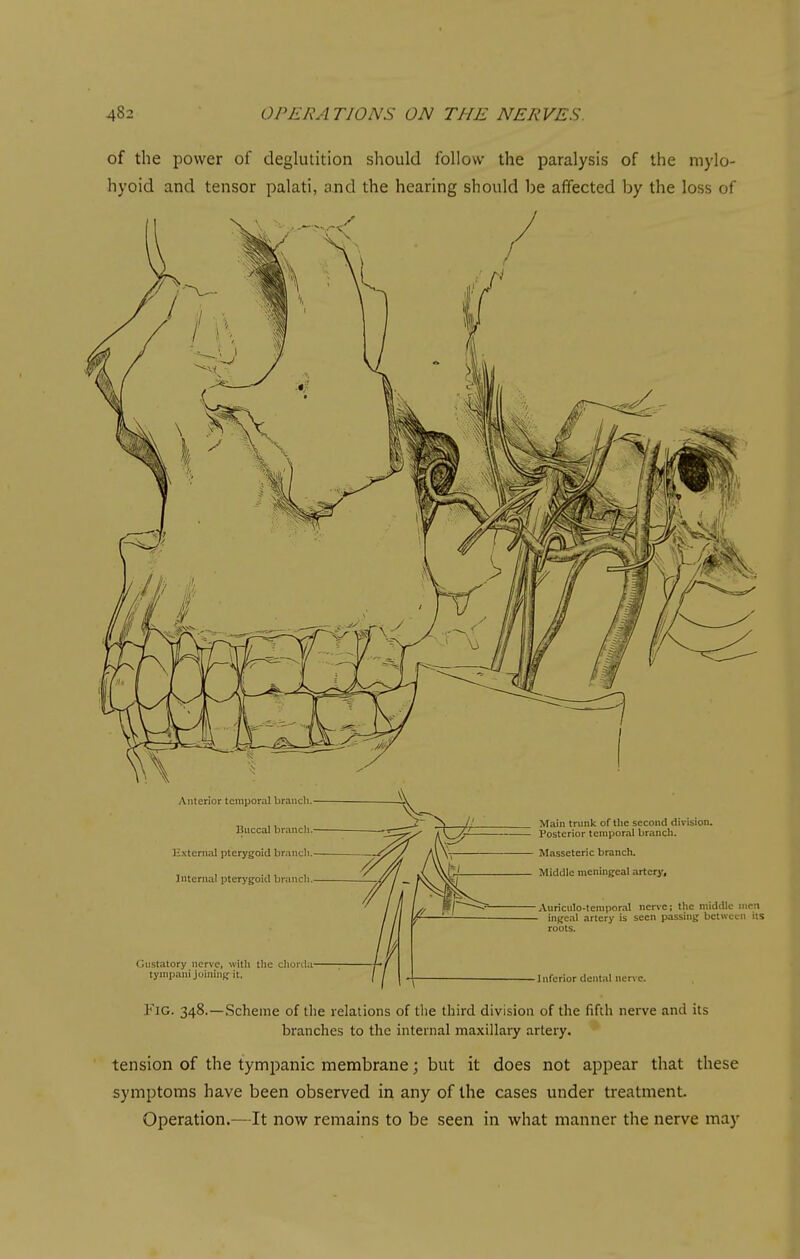 of the power of deglutition should follow the paralysis of the mylo- hyoid and tensor palati, and the hearing should be affected by the loss of Fig. 348.—Scheme of tlie relations of tlie third division of the fifth nerve and its branches to the internal maxillary artery. tension of the tympanic membrane; but it does not appear that these symptoms have been observed in any of the cases under treatment. Operation.—It now remains to be seen in what manner the nerve may