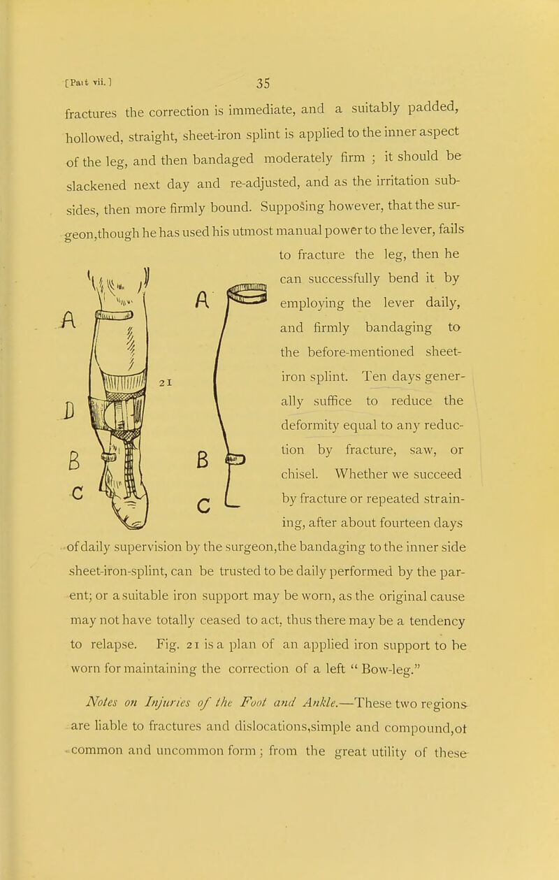 fractures the correction is immediate, and a suitably padded, hollowed, straight, sheet-iron splint is applied to the inner aspect of the leg, and then bandaged moderately firm ; it should be slackened next day and re-adjusted, and as the irritation sub- sides, then more firmly bound. Supposing however, that the sur- geon,though he has used his utmost manual power to the lever, fails to fracture the leg, then he 13) \ 21 c ^ can successfully bend it by employing the lever daily, and firmly bandaging to the before-mentioned sheet- iron splint. Ten days gener- ally suffice to reduce the deformity equal to any reduc- tion by fracture, saw, or chisel. Whether we succeed by fracture or repeated strain- ing, after about fourteen days of daily supervision by the surgeon,the bandaging to the inner side sheet-iron-splint, can be trusted to be daily performed by the par- ent; or a suitable iron support may be worn, as the original cause may not have totally ceased to act, thus there may be a tendency to relapse. Fig. 21 is a plan of an applied iron support to be worn for maintaining the correction of a left  Bow-leg. Notes on Injuries of the Foot and Ankle.—These two regions- are liable to fractures and dislocations,simple and compound,ot ■ common and uncommon form ; from the great utility of these