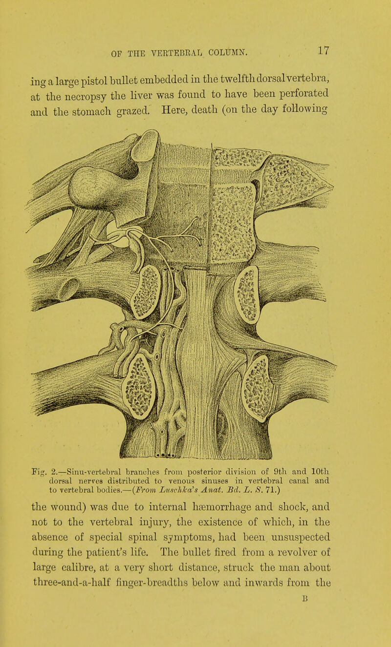 ing a large pistol bnllet embedded in the twelfth dorsal vertebra, at the necropsy the liver was found to have been perforated and the stomach grazed. Here, death (on the day following Fig. 2.—Sinu-vei'fcebral branches from posterior division of 9tli and 10th dorsal nerves distributed to venous sinuses in vertebral canal and to vertebral bodies.—(From Jjuschka's Anat. Bd. L. S. 71.) the wound) was due to internal haemorrhage and shock, and not to the vertebral injury, the existence of which, in the absence of special spinal symptoms, had been unsuspected during the patient's life. The bullet fired from a revolver of large calibre, at a very short distance, struclv the man about three-and-a-half finger-breadtlis below and inwards from the B