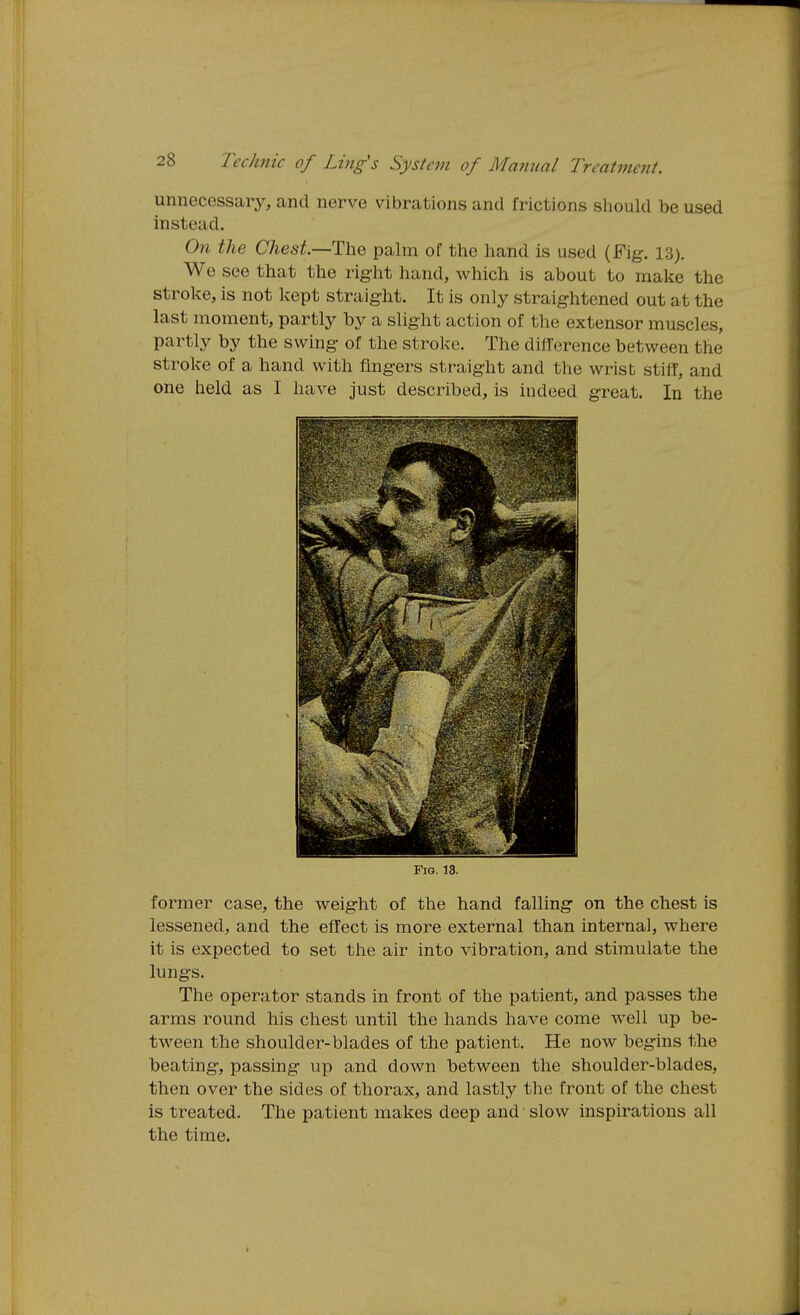 unnecessar3^ and nerve vibrations and frictions should be used instead. On tlie Chest—The palm of the hand is used (Fig. 13). We see that the right hand, which is about to make the stroke, is not kept straight. It is only straightened out at the last moment, partly by a slight action of the extensor muscles, partly by the swing of the stroke. The difference between the stroke of a hand with fingers straight and the wrist stiff, and one held as I have just described, is indeed great. In the Fig. 13. former case, the weight of the hand falling on the chest is lessened, and the effect is more external than internal, where it is expected to set the air into vibration, and stimulate the lungs. The operator stands in front of the patient, and passes the arms round his chest until the hands have come well up be- tween the shoulder-blades of the patient. He now begins the beating, passing up and down between the shoulder-blades, then over the sides of thorax, and lastly the front of the chest is treated. The patient makes deep and • slow inspirations all the time.