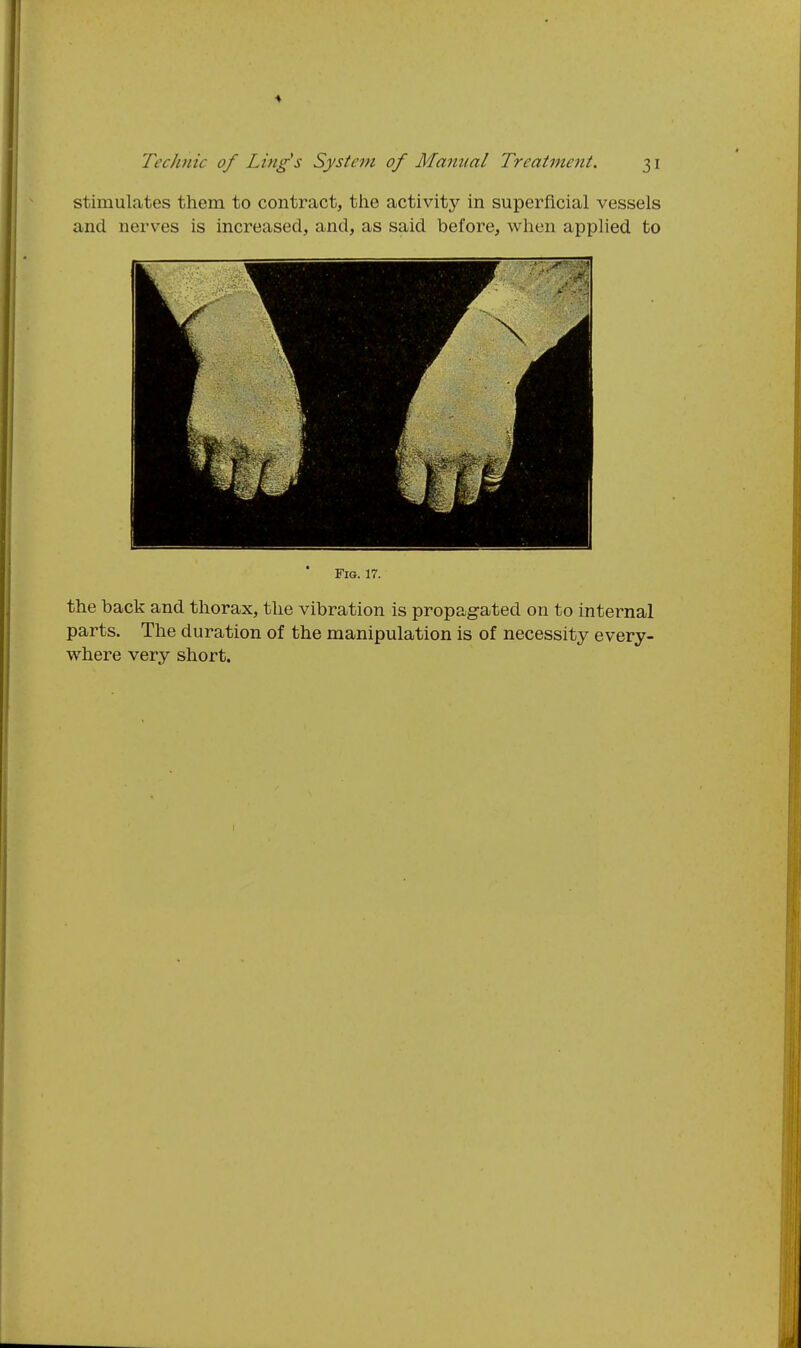 stimulates them to contract, the activity in superficial vessels and nerves is increased, and, as said before, when applied to Fig. 17. the back and thorax, the vibration is propagated on to internal parts. The duration of the manipulation is of necessity every- where very short.