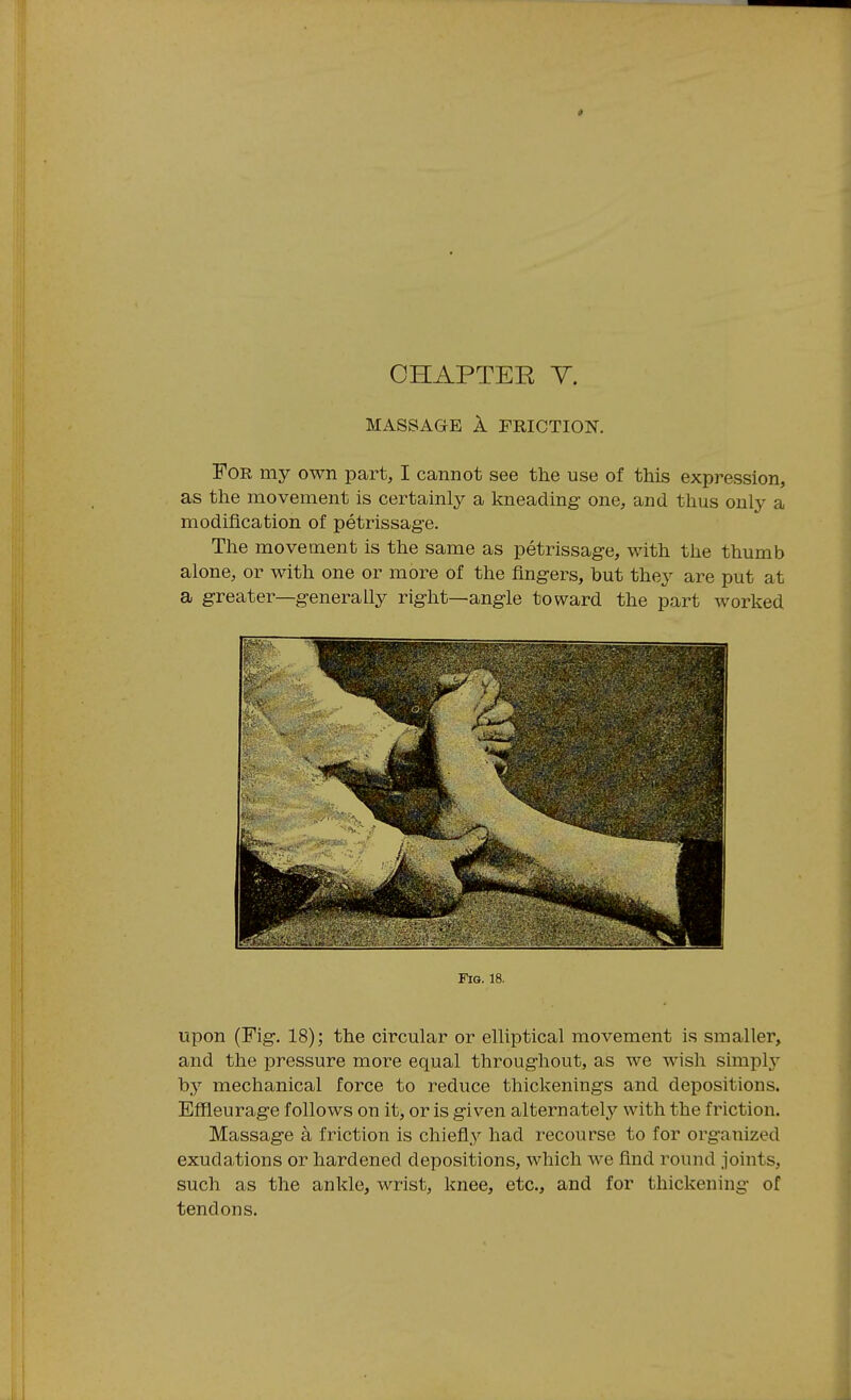 MASSAGE A FRICTION. For my own part, I cannot see the use of this expression, as the movement is certainly a kneading- one, and thus only a modification of petrissage. The movement is the same as petrissage, with the thumb alone, or with one or more of the fingers, but they are put at a greater—generally right—angle toward the part worked Fig. 18. upon (Fig. 18); the circular or elliptical movement is smaller, and the pressure more equal throughout, as we wish simplj- by mechanical force to reduce thickenings and depositions. Effleurage follows on it, or is given alternately with the friction. Massage a friction is chiefly had recourse to for organized exudations or hardened depositions, which we find round joints, such as the ankle, wrist, knee, etc., and for thickening of tendons.