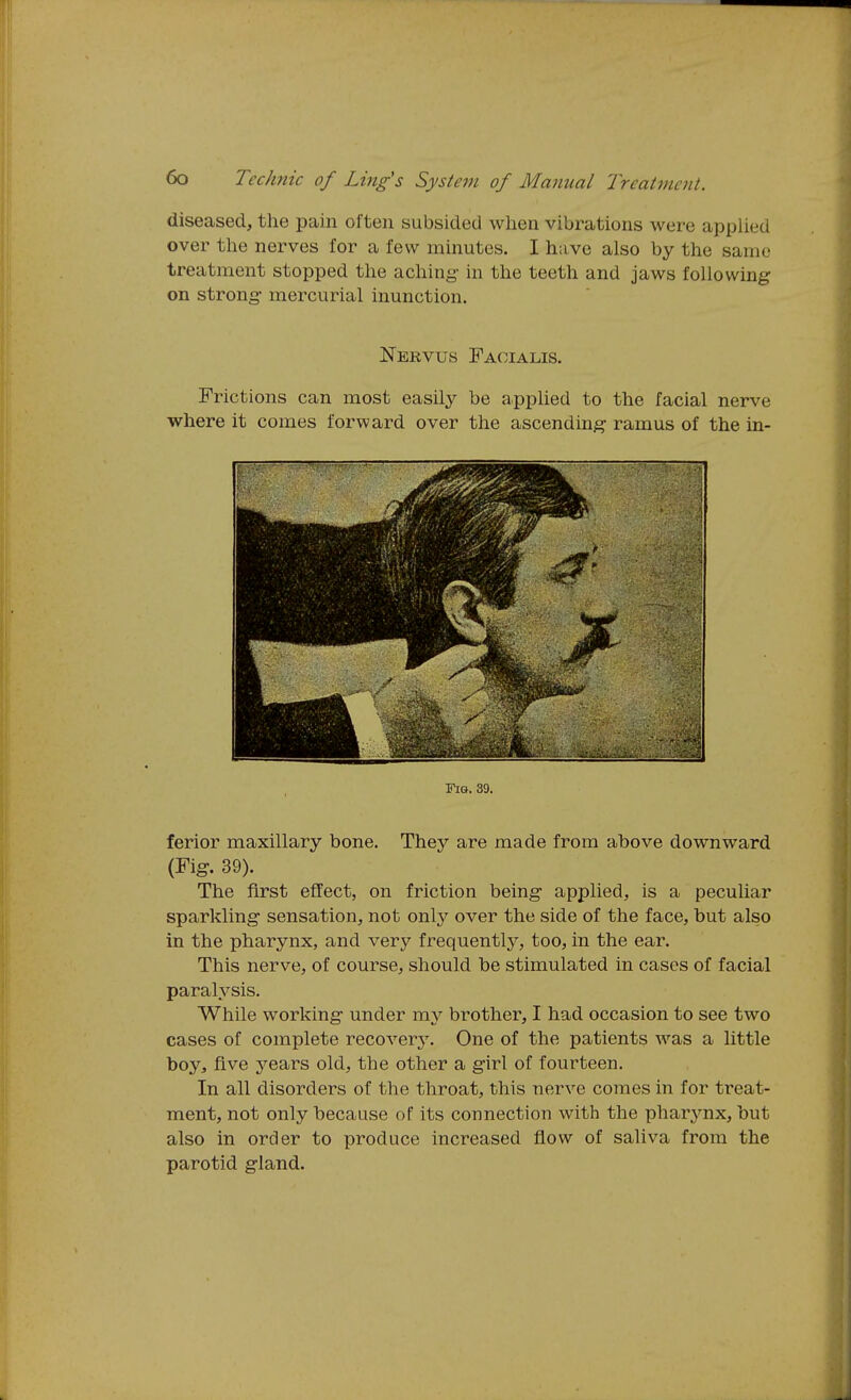 diseased, the pain often subsided when vibrations were applied over the nerves for a few minutes. I have also by the same treatment stopped the aching in the teeth and jaws following on strong mercurial inunction. Nervus Facialis. Frictions can most easily be applied to the facial nerve where it comes forward over the ascending ramus of the in- Fio. 39. ferior maxillary bone. They are made from above downward (Fig. 39). The first effect, on friction being applied, is a peculiar sparkling sensation, not only over the side of the face, but also in the pharynx, and very frequently, too, in the ear. This nerve, of course, should be stimulated in cases of facial paralysis. While working under my brother, I had occasion to see two cases of complete recover^'. One of the patients was a little boy, five years old, the other a girl of fourteen. In all disorders of the throat, this nerve comes in for treat- ment, not only because of its connection with the pharjmx, but also in order to produce increased flow of saliva from the parotid gland.