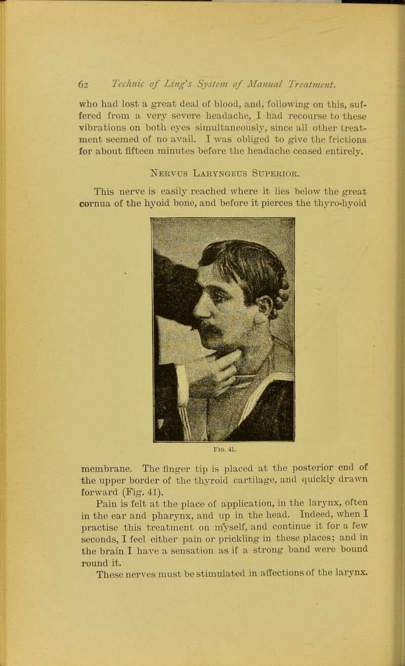 who had lost a great deal of blood, and, following on this, suf- fered from a very severe headache, I had recourse to these vibrations on both eyes simultaneously, since all other treat- ment seemed of no avail. I was obliged to give the frictions for about fifteen minutes before the headache ceased entirely. Nervds Laryngeus Superior. This nerve is easily reached where it lies below the great cornua of the hyoid bone, and before it pierces the thyro-hyoid Fig. 41. membrane. The finger tip is placed at the posterior end of the upper border of the thyroid cartilage, and quickly drawn forward (Fig. 41). Pain is felt at the place of application, in the larynx, often in the ear and pharynx, and up in the head. Indeed, when I practise this treatment on myself, and continue it for a few seconds, I feel either pain or prickling in these places; and in the brain I have a sensation as if a strong band were bound round it. These nerves must be stimulated in affections of the larynx.