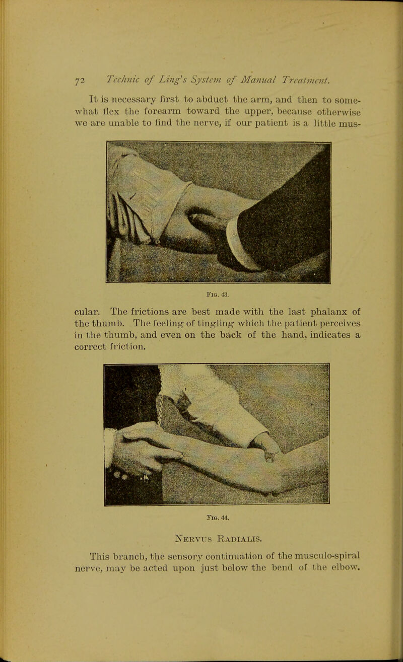 It is necessary first to abduct the arm, and then to some- what flex the forearm toward the upper, because otlierwise we are unable to find the nerve, if our patient is a little mus- FlG. 43. cular. The frictions are best made with the last phalanx of the thumb. The feeling- of tingling- which the patient perceives in the thumb, and even on the back of the hand, indicates a correct friction. Fig. 44. Nervus Radialis. This branch, the sensory continuation of the musculo-spiral nerve, may be acted upon just below the bend of the elbow.