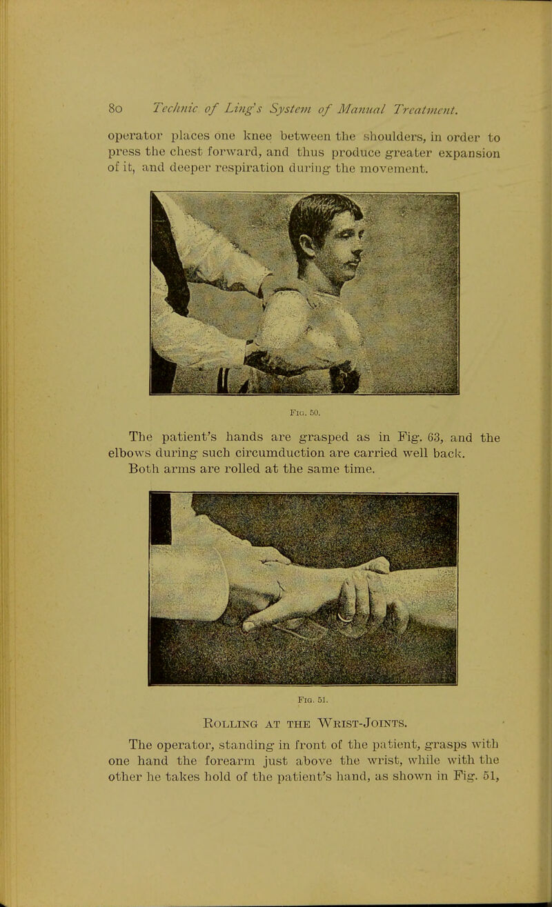 operator places one knee between the shoulders, in order to press the chest forward, and thus produce greater expansion of it, and deeper respiration during- the movement. Fig. 50. The patient's hands are grasped as in Fig. 63, and the elbows during such circumduction are carried well back. Both arms are rolled at the same time. Fig. 51. Rolling at the Wrist-Joints. The operator, standing in front of the patient, grasps with one hand the forearm just above the wrist, while with the other he takes hold of the patient's hand, as shown in Fig. 51,