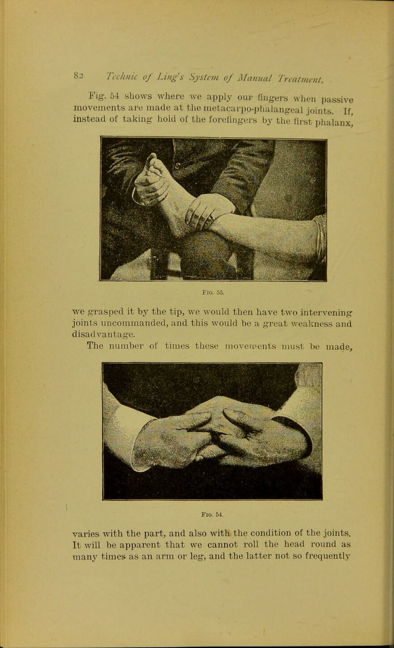 Fig-. 54 shows where we apply our Tiug-ers wlieii passive movements are made at the metacarpo-plialang-eal joints. If instead of taking- hold of the forefingers by the fh-st phalanx^ Fig. 53. we g-rasped it by the tip, we would then have two intervening- joints uncommanded, and this would be a great weakness and disadvantage. The number of times these movements must be made. Fig. 54. varies with the part, and also with the condition of the joints. It will be apparent that we cannot roll the head round as many times as an arm or leg, and the latter not so frequently