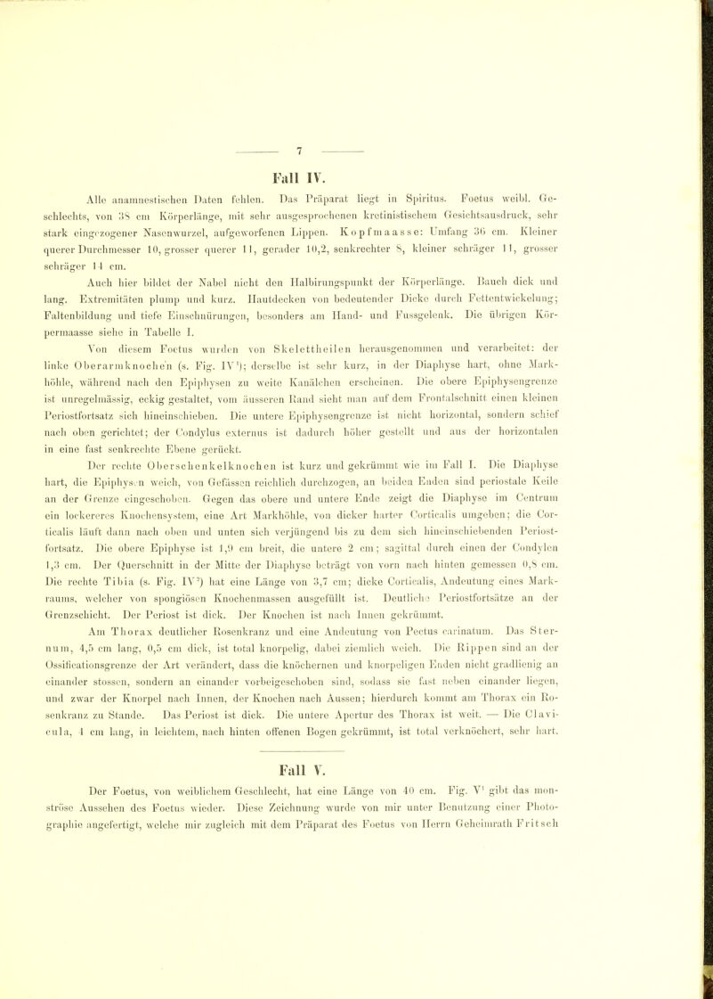 Fall IV. Alle anamnestischen Daten fehlen. Das Präparat liegt in Spiritus. Foetus weibl. Ge- schlechts, von 38 cm Körperlänge, mit sehr ausgesprochenen kretinistischem Gesichtsausdruck, sehr stark eingezogener Nasenwurzel, aufgeworfenen Lippen. Kopfmaasse: Umfang 30 cm. Kleiner querer Durchmesser 10, grosser querer 11, gerader 10,2, senkrechter 8, kleiner schräger 11, grosser schräger 14 cm. Auch hier bildet der Nabel nicht den Ilalbirungspunkt der Körperlänge. Bauch dick und lang. Extremitäten plump und kurz. Hautdecken von bedeutender Dicke durch Fettentwickelung; Faltenbildung und tiefe Einschnürungen, besonders am Hand- und Fussgelenk. Die übrigen Kör- permaasse siehe in Tabelle I. Von diesem Foetus wurden von Skelettheilen herausgenommen und verarbeitet: der linke Oberarmknoche'n (s. Fig. IY1); derselbe ist sehr kurz, in der Diaphyse hart, ohne Mark- höhle, während nach den Epiphysen zu weite Kanälchen erscheinen. Die obere Epiphysengrenze ist unregelmässig, eckig gestaltet, vom äusseren Rand sieht man auf dem Frontalschnitt einen kleinen Periostfortsatz sich hineinschieben. Die untere Epiphysengrenze ist nicht horizontal, sondern schief nach oben gerichtet; der Condylus externus ist dadurch höher gestellt und aus der horizontalen in eine fast senkrechte Ebene gerückt. Der rechte Oberschenkelknochen ist kurz und gekrümmt wie im Fall I. Die Diaphyse hart, die Epiphysen weich, von Gefässen reichlich durchzogen, an beiden Enden sind periostale Keile an der Grenze eingeschoben. Gegen das obere und untere Ende zeigt die Diaphyse im Centrum ein lockereres Knochensystom, eine Art Markhöhle, von dicker harter Corticalis umgeben; die Cor- ticalis läuft dann nach oben und unten sich verjüngend bis zu dem sich hineinschiebenden Periost- fortsatz. Die obere Epiphyse ist 1,9 cm breit, die untere 2 cm; sagittal durch einen der Condylen 1,:! cm. Der Querschnitt in der Mitte der Diaphyse beträgt von vorn nach hinten gemessen 0,8 cm. Die rechte Tibia (s. Fig. IV2) hat eine Länge von 3,7 cm; dicke Corticalis, Andeutung eines Mark- raums, welcher von spongiösen Knochenmassen ausgefüllt ist. Deutliche Periostfortsätze an der Grenzschicht. Der Periost ist dick. Der Knochen ist nach Innen gekrümmt. Am Thorax deutlicher Rosenkranz und eine Andeutung von Pectus carinatum. Das Ster- liuiii, 4,5 cm lang, 0,5 cm dick, ist total knorpelig, dabei ziemlich weich. Die Rippen sind an der Ossificationsgrenzc der Art verändert, dass die knöchernen und knorpeligen Enden nicht gradlienig an einander stossen, sondern an einander vorbeigeschoben sind, sodass sie fast neben einander liegen, und zwar der Knorpel nach Innen, der Knochen nach Aussen; hierdurch kommt am Thorax ein Ro- senkranz zu Stande. Das Periost ist dick. Die untere Apertur des Thorax ist weit. —■ Die Clavi- cula, 4 cm lang, in leichtem, nach hinten offenen ßogen gekrümmt, ist total verknöchert, sehr hart. Fall V. Der Foetus, von weiblichem Geschlecht, hat eine Länge von 40 cm. Fig. V gibt das mon- ströse Aussehen des Foetus wieder. Diese Zeichnung wurde von mir unter Benutzung einer Photo- graphie angefertigt, welche mir zugleich mit dem Präparat des Foetus von Herrn Geheimrath Fritsch