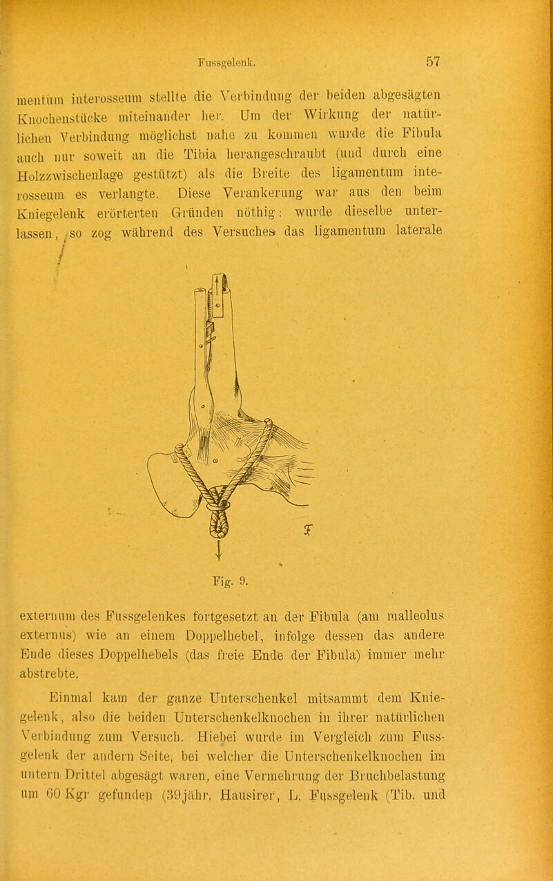 mentiim interosseum stellte die Verbindung der beiden abgesägten Knocheustiicke miteinander her. Um der Wirkung der natür- lichen Verbindung möglichst nahe zu kummen wurde die Fibula auch nur soweit an die Tibia herangeschraubt (und durch eine Holzzwischeiilage gestützt) als die Breite des ligamentum inte- rosseum es verlangte. Diese Verankerung war aus den beim Kniegelenk erörterten Gründen nöthig: wurde dieselbe unter- lassen, so zog während des Versuches, das ligamentum laterale I Fig. 9. extern um des Fussgelenkes fortgesetzt an der Fibula (am raalleolus externus) wie an einem Doppelhebel, infolge dessen das andere Ende dieses Doppelhebels (das fi'eie Ende der Fibula) immer mehr abstrebte. Einmal kam der ganze Unterschenkel mitsammt dem Knie- gelenk, also die beiden Unterschenkelknochen in ihrer natürlichen Verbindung zum Versuch. Hiebei wurde im Vergleich zum Fuss- gelenk der andern Seite, bei welcher die ünterschenkelknochen im untern Drittel abgesägt waren, eine Vermehrung der Bruchbelastung um 60 Kgr gefunden (39jähr, Hausirer, L. Fqssgelenk (Tib. und