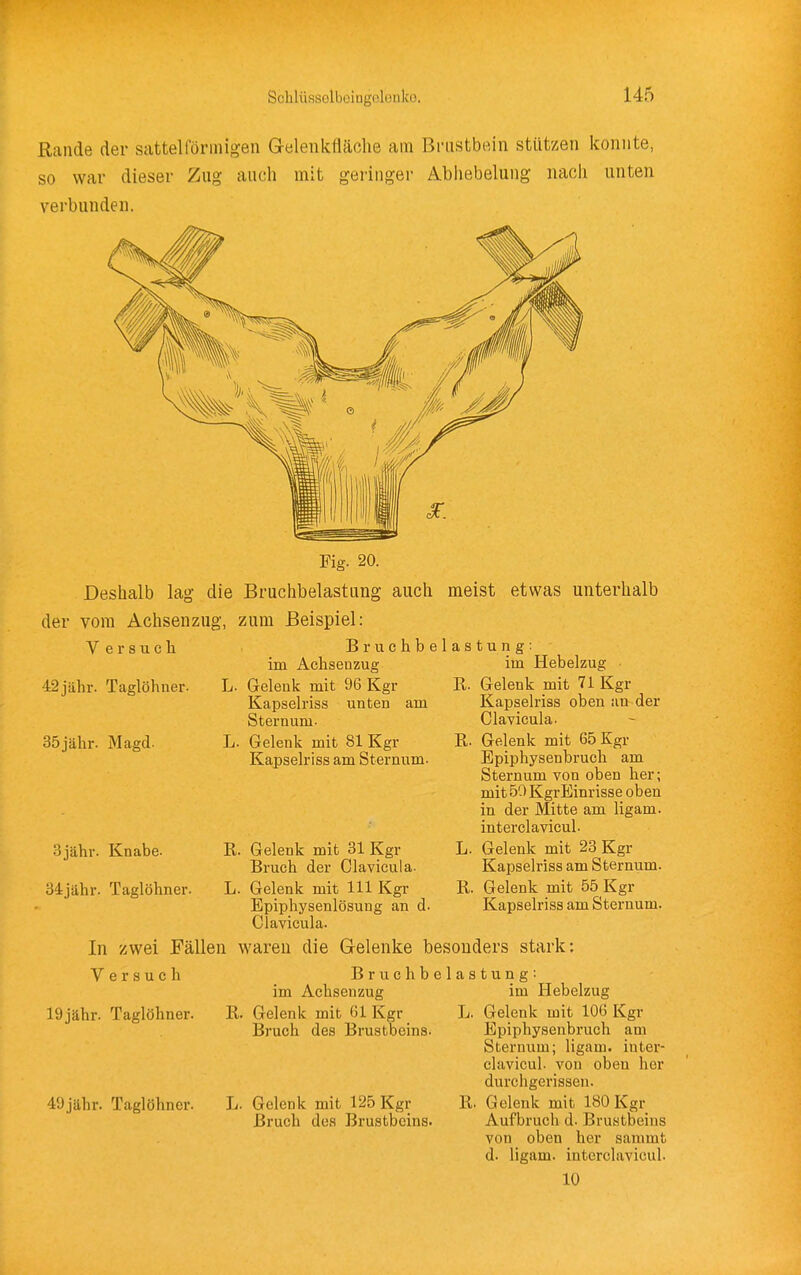 Rande der sattelförinigen G-elenkfläclie am Briistbttin stützen konnte, so war dieser Zug auch mit geringer Abliebelung nacii unten verbunden. Fig. 20. Deshalb lag die Bruchbelastung auch meist etwas unterhalb der vom Achsenzug, zum Beispiel: Versuch 42jähr. Taglöhner. 35jähr. Magd. Bruchbelastung: im Achseuzug im Hebelzug L. Gelenk mit 96 Kgr Kapselriss unten am Sternum. L. Gelenk mit 81 Kgr Kapselriss am Sternum. 3jähr. Knabe. 34jähr. Taglöhner R. Gelenk mit 31 Kgr Bruch der Clavicula- L. Gelenk mit III Kgr Epiphysenlösung an d Clavicula. In zwei Pällen waren die Gelenke besonders stark: Versuch R. Gelenk mit 71 Kgr Kapselriss oben an der Clavicula. R. Gelenk mit 65 Kgr Bpiphysenbruch am Sternum von oben her; mit 50 KgrBinrisse oben in der Mitte am ligam. interclavicul. L. Gelenk mit 23 Kgr Kapselriss am Sternum. R. Gelenk mit 55 Kgr Kapselriss am Sternum. Bruchbelastung: im Achsenzug im Hebelzug 19jähr. Taglöhner. 49jähr. Taglöhner. R. Gelenk mit 61 Kgr Bruch des Brustbeins. L. Gelenk mit 125 Kgr Bruch des Brustbeins. L. Gelenk mit 106 Kgr Epiphysenbruch am Sternum; ligam. inter- clavicul. von oben her durchgerissen. R. Gelenk mit 180 Kgr Aufbruch d. Brustbeins von oben her sammt d. ligam. interclavicul. 10
