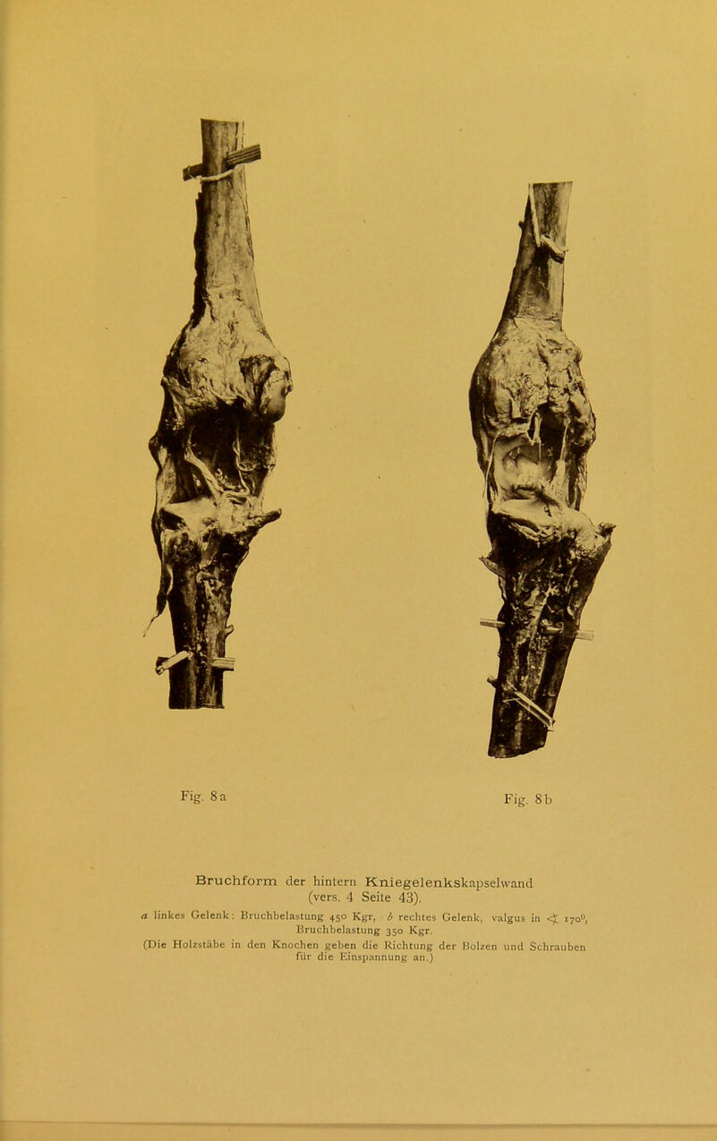 Bruchform der hintern Kniegelenkskapselwand (vers. 4 Seite 43). a linkes Gelenk: Bruchbelastung 450 Kgr, b rechtes Gelenk, valgus in <J 170, Bruchbelastung 350 Kgr. (Die Holzstäbe in den Knochen geben die Richtung der Holzen und Schrauben für die ICinspannung an.)