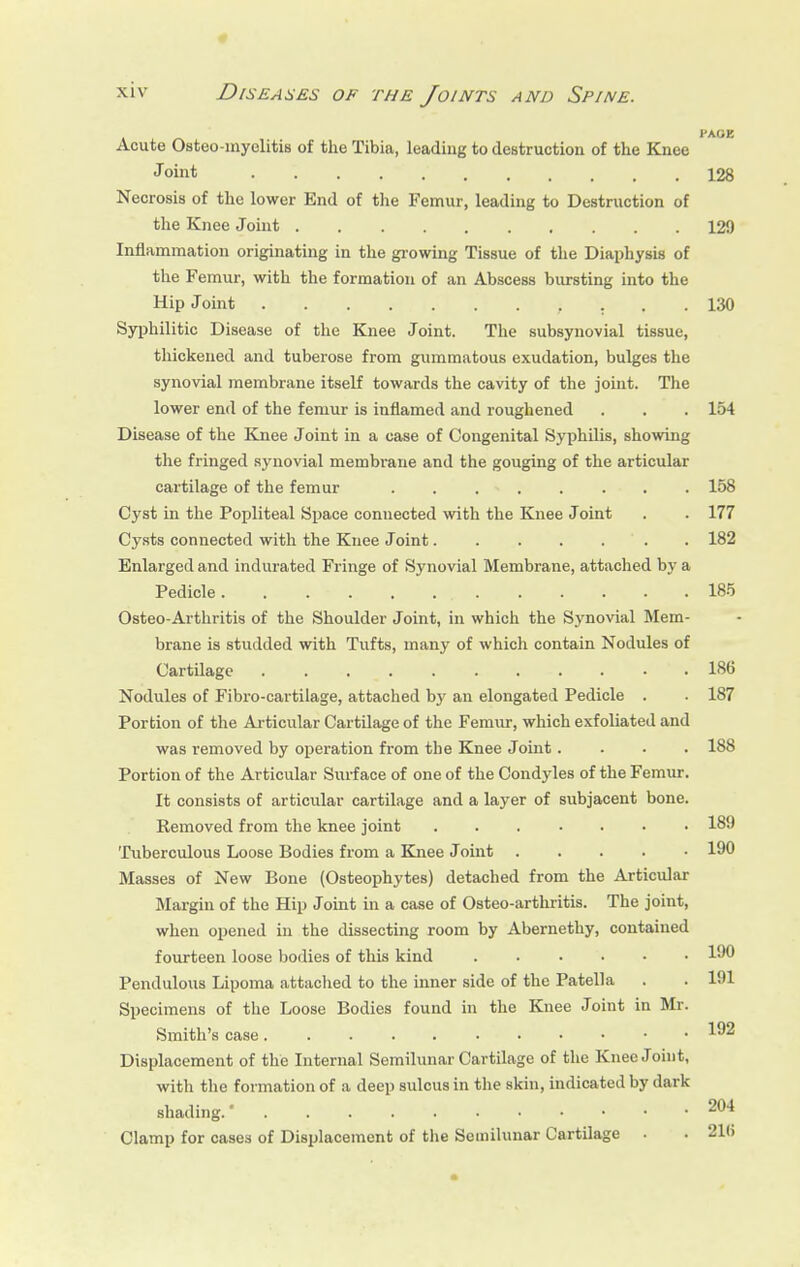 J* AGE Acute Osteo-myelitis of the Tibia, leading to destruction of the Knee J oint 128 Necrosis of the lower End of the Femur, leading to Destruction of the Knee Joint 129 Inflammation originating in the glowing Tissue of the Diaphysis of the Femur, with the formation of an Abscess bursting into the Hip Joint , ... 130 Syphilitic Disease of the Knee Joint. The subsynovial tissue, thickened and tuberose from gummatous exudation, bulges the synovial membrane itself towards the cavity of the joint. The lower end of the femur is inflamed and roughened . . . 154 Disease of the Knee Joint in a case of Congenital Syphilis, showing the fringed synovial membrane and the gouging of the articular cartilage of the femur . . 158 Cyst in the Popliteal Space connected with the Knee Joint . . 177 Cysts connected with the Knee Joint . 182 Enlarged and indurated Fringe of Synovial Membrane, attached by a Pedicle. . . 185 Osteo-Arthritis of the Shoulder Joint, in which the Synovial Mem- brane is studded with Tufts, many of which contain Nodules of Cartilage . . . . . . . . • • 186 Nodules of Fibro-cartilage, attached by an elongated Pedicle . . 187 Portion of the Articular Cartilage of the Femur, which exfoliated and was removed by operation from the Knee Joint.... 188 Portion of the Articular Surface of one of the Condyles of the Femur. It consists of articular cartilage and a layer of subjacent bone. Removed from the knee joint ....... 189 Tuberculous Loose Bodies from a Knee J oint 190 Masses of New Bone (Osteophytes) detached from the Articular Margin of the Hip Joint in a case of Osteo-arthritis. The joint, when opened in the dissecting room by Abernethy, contained fourteen loose bodies of this kind 190 Pendulous Lipoma attached to the inner side of the Patella . . 191 Specimens of the Loose Bodies found in the Knee Joint in Mr. Smith's case 192 Displacement of the Internal Semilunar Cartilage of the Knee Joint, with the formation of a deep sulcus in the skin, indicated by dark shading.' 204 Clamp for cases of Displacement of the Semilunar Cartilage . . 21(i