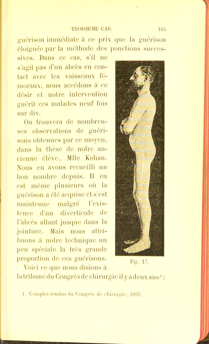 guérison immédiate à ce prix que la guérison éloignée par la méthode des ponctions succes- sives. Dans ce cas, s'il ne s'agit pas d'un abcès en con- tact avec les vaisseaux fé- moraux, nous accédons à ce désir et notre intervention guérit ces malades neuf fois sur dix. On trouvera de nombreu- ses observations de guéri- sons obtenues par ce moyen, dans la thèse de notre an- cienne élève, Mlle Kohan. Nous en avons recueilli un bon nombre depuis. Il en est même plusieurs où la guérison a été acquise et s'est maintenue malgré l'exis- tence <l'un diverticule de l'abcès allant jusque dans la jointure. Mais nous attri- buons à noire technique un peu spéciale la Irès grande proportion de ces guérisons. Voici ce que nous disions à la tribune du Congrès de chirurgie il y a deux ans1 : 1. Comptes rendus du Congrès de chirurgie. 1893,