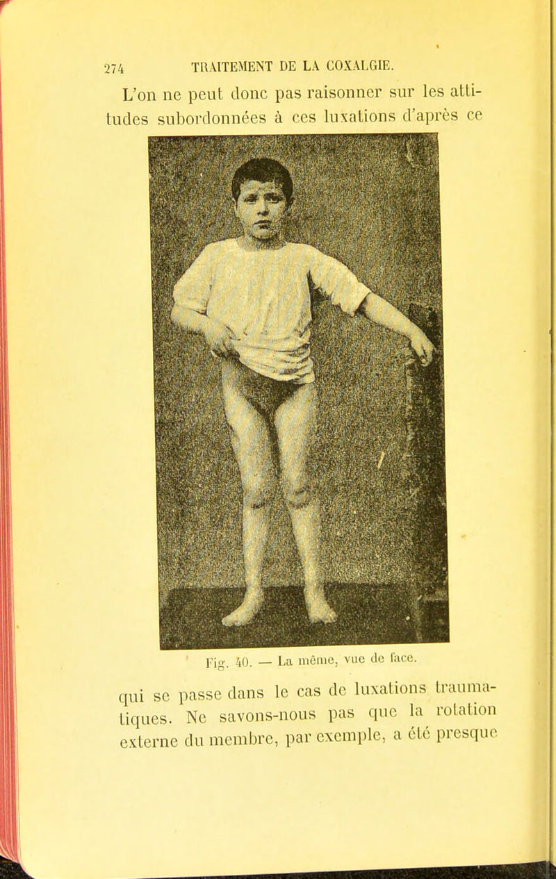 L'on ne peut donc pas raisonner sur les atti- tudes subordonnées à ces luxations d'après ce 4 !' . Si;' Pi„ 40. — La môme, vue de face. qui se passe dans le cas de luxations trauma- tiques. Ne savons-nous pas que la rotation externe du membre, par exemple, a été presque