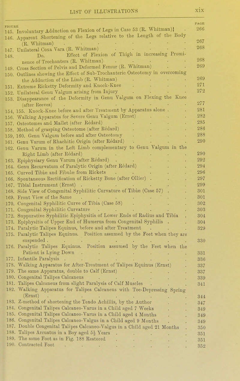 PAGE llCInvoluntary Adduction on Flexion of Legs in Case 53 (R. Whitman)] . 266 146. Apparent Shortening of the Legs relative to the Length of the Body (R. Whitman) 267 147. Unilateral Coxa Vara (R. Whitman) . • • .268 148 Do. Effect of Flexion of Thigh in increasing Promi- nence of Trochanters (R. Whitman) ..... 268 149. Cross Section of Pelvis and Deformed Femur (R. Whitman) . . 269 150. Outlines showing the Effect of Sub-Trochanteric Osteotomy in overcoming the Adduction of the Limb (R. Whitman) . . . .269 151. Extreme Ricketty Deformity and Knock-Knee . . . .271 152. Unilateral Genu Valgum arising from Injury . . . .272 153. Disappearance of the Deformity in Genu Valgum on Flexing the Knee (after Reeves) 277 154. 155. Knock-Knee before and after Treatment by Apparatus alone . . 281 156. Walking Apparatus for Severe Genu Valgum (Ernst) . . . 282 157. Osteotomes and Mallet (after Redard) ..... 285 158. Method of grasping Osteotome (after Redard) .... 286 159. 160. Genu Valgum before and after Osteotomy .... 288 161. Genu Varum of Rhachitic Origin (after Redard) .... 290 162. Genu Varum in the Left Limb complementary to Genu Valgum in the Right Limb (after Redard) ...... 290 163. Epiphysiary Genu Varum (after Redard) ..... 292 164. Genu Recurvatum of Paralytic Origin (after Redard) . . . 294 165. Curved Tibia? and Fibula? from Rickets ..... 296 166. Spontaneous Rectification of Ricketty Bone (after Oilier) . . . 297 167. Tibial Instrument (Ernst) ....... 299 168. Side View of Congenital Syphilitic Curvature of Tibiae (Case 57) . . 301 169. Front View of the Same . . . . . ' . .301 170. Congenital Syphilitic Curve of Tibia (Case 58) . . . .302 171. Congenital Syphilitic Curvature ...... 303 172. Suppurative Syphilitic Epiphysitis of Lower Ends of Radius and Tibia . 304 173. Epiphysitis of Upper End of Humerus from Congenital Syphilis . . 304 174. Paralytic Talipes Equinus, before and after Treatment . . . 329 175. Paralytic Talipes Equinus. Position assumed by the Feet when they are suspended ......... 330 176. Paralytic Talipes Equinus. Position assumed by the Feet when the Patient is Lying Down . . . . . . 331 177. Infantile Paralysis ........ 336 178. Walking Apparatus for After-Treatment of Talipes Equinus (Ernst) . 337 179. The same Apparatus, double to Calf (Ernst) .... 337 180. Congenital Talipes Calcaneus ...... 339 181. Talipes Calcaneus from slight Paralysis of Calf Muscles . . . 341 182. Walking Apparatus for Talipes Calcaneus with Toe-Depressing Spring (Ernst) ......... 344 183. Z-method of shortening the Tendo Achillis, by the Author . . 347 184. Congenital Talipes Calcaneo-Varus in a Child aged 7 Weeks . . 349 185. Congenital Talipes Calcaneo-Varus in a Child aged 4 Months . . 349 186. Congenital Talipes Calcaneo-Valgus in a Child aged 9 Months . . 349 187. Double Congenital Talipes Calcaneo-Valgus in a Child aged 21 Months . 350 188. Talipes Arcuatus in a Boy aged 5h Years ..... 351 189. The same Foot as in Fig. 188 Restored ..... 351 190. Contracted Foot . . . ■ . . . . . 352
