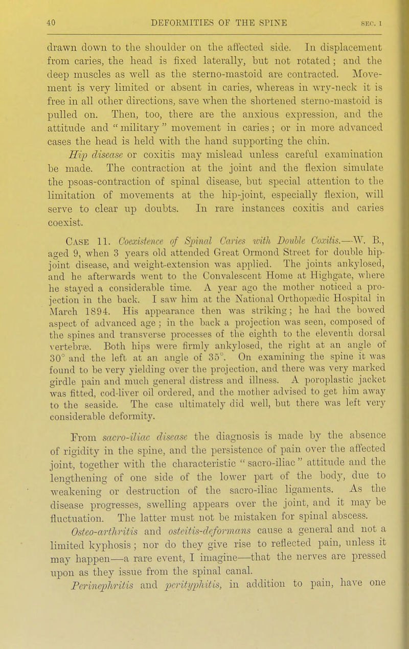 drawn down to the shoulder on the affected side. In displacement from caries, the head is fixed laterally, bnt not rotated; and the deep muscles as well as the sterno-mastoid are contracted. Move- ment is very limited or absent in caries, whereas in wry-neck it is free in all other directions, save when the shortened sterno-mastoid is pulled on. Then, too, there are the anxious expression, and the attitude and  military  movement in caries ; or in more advanced cases the head is held with the hand supporting the chin. Hip disease or coxitis may mislead unless careful examination be made. The contraction at the joint and the flexion simulate the psoas-contraction of spinal disease, but special attention to the limitation of movements at the hip-joint, especially flexion, will serve to clear up doubts. In rare instances coxitis and caries coexist. Case 11. Coexistence of Spinal Caries with Double Coxitis.—W. B., aged 9, when 3 years old attended Great Ormond Street for double hip- joint disease, and weight-extension was applied. The joints ankylosed, and he afterwards went to the Convalescent Home at Highgate, where he stayed a considerable time. A year ago the mother noticed a pro- jection in the back. I saw him at the National Orthopsedic Hospital in March 1894. His appearance then was striking; he had the bowed aspect of advanced age ; in the back a projection was seen, composed of the spines and transverse processes of the eighth to the eleventh dorsal vertebrae. Both hips were firmly ankylosed, the right at an angle of 30° and the left at an angle of 35°. On examining the spine it was found to be very yielding over the projection, and there was very marked girdle pain and much general distress and illness. A poroplastic jacket was fitted, cod-liver oil ordered, and the mother advised to get him away to the seaside. The ease ultimately did well, but there was left very considerable deformity. From sacro-iliac disease the diagnosis is made by the absence of rigidity in the spine, and the persistence of pain over the affected joint, together with the characteristic sacro-iliac attitude and the lengthening of one side of the lower part of the body, due to weakening or destruction of the sacro-iliac ligaments. As the disease progresses, swelling appears over the joint, and it may be fluctuation. The latter must not be mistaken for spinal abscess. Osteo-arthritis and ostcitis-deformans cause a general and not a limited kyphosis ; nor do they give rise to reflected pain, unless it may happen—a rare event, I imagine—that the nerves are pressed upon as they issue from the spinal canal. Perinephritis and perityphitis, in addition to pain, have one