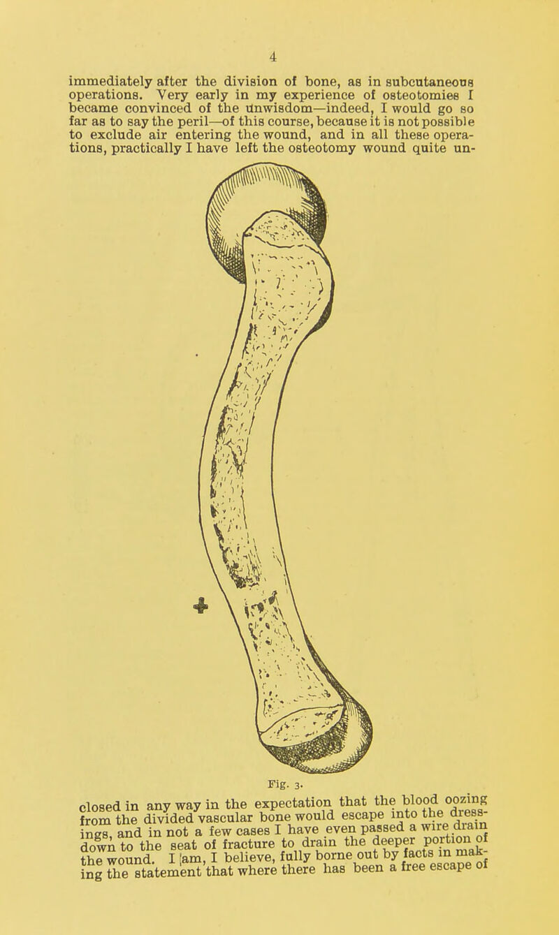 immediately after the division of bone, as in subcutaneons operations. Very early in my experience of osteotomies I became convinced of the unwisdom—indeed, I would go so far as to say the peril—of this course, because it is not possible to exclude air entering the wound, and in all these opera- tions, practically I have left the osteotomy wound quite un- Fig. 3- closed in any way in the expectation that the blood oozing from the divided vascular bone would escape into the dress ingi and in not a few cases I have even passed a wire drain dowi tS the seat of fracture to drain the f^eper portion of the wound. I [am, I believe, fully borne out by facts in mak- ing The statement'that where there has been a free escape of