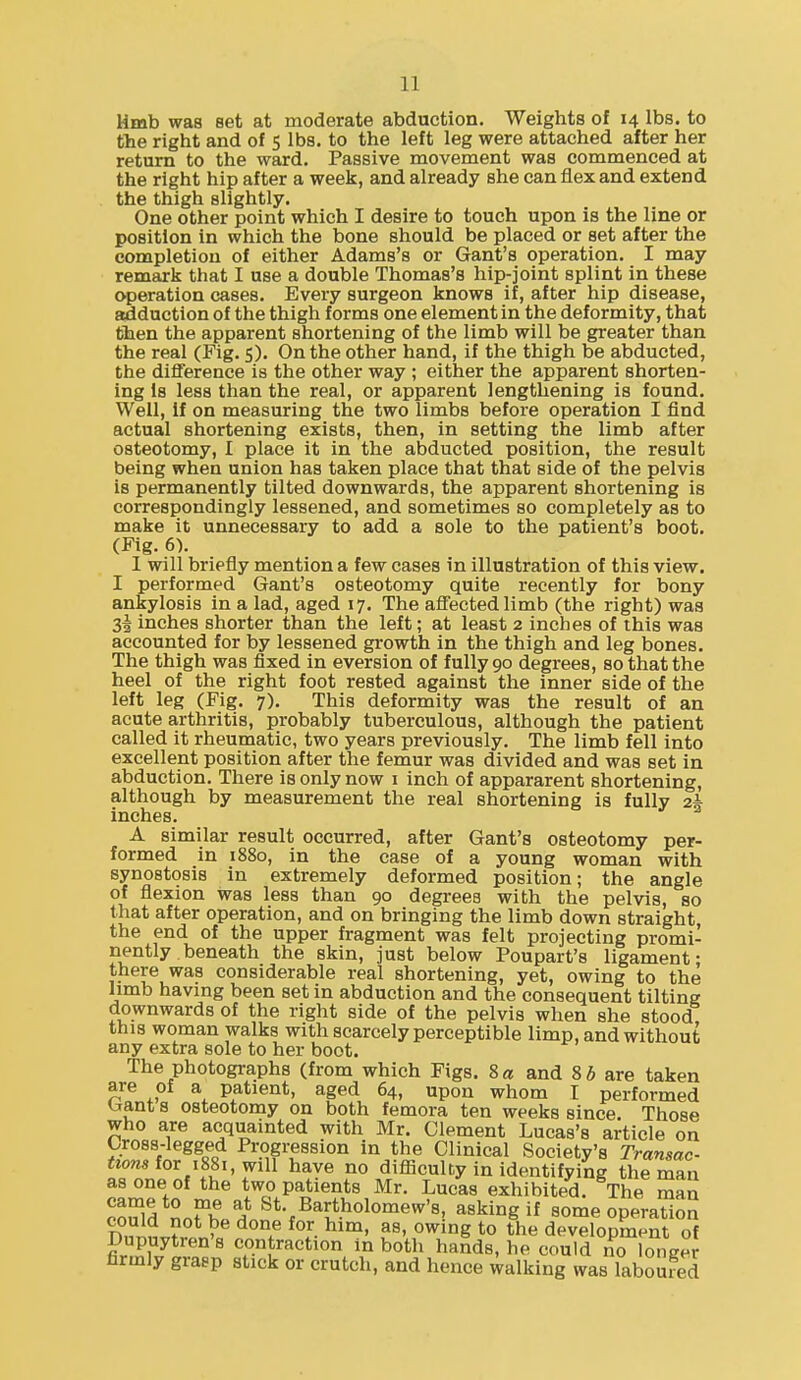 Hmb was set at moderate abduction. Weights of 14 lbs. to the right and of 5 lbs. to the left leg were attached after her return to the ward. Passive movement was commenced at the right hip after a week, and already she can flex and extend the thigh slightly. One other point which I desire to touch upon is the line or position in which the bone should be placed or set after the completion of either Adams's or Gant's operation. I may remark that I use a double Thomas's hip-joint splint in these operation cases. Every surgeon knows if, after hip disease, adduction of the thigh forms one element in the deformity, that then the apparent shortening of the limb will be greater than the real (Fig. 5). On the other hand, if the thigh be abducted, the difference is the other way ; either the apparent shorten- ing Is less than the real, or apparent lengthening is found. Well, If on measuring the two limbs before operation I find actual shortening exists, then, in setting the limb after osteotomy, I place it in the abducted position, the result being when union has taken place that that side of the pelvis is permanently tilted downwards, the apparent shortening is correspondingly lessened, and sometimes so completely as to make it unnecessary to add a sole to the patient's boot. (Fig. 6). 1 will briefly mention a few cases in illustration of this view. I performed Gant's osteotomy quite recently for bony ankylosis in a lad, aged 17. The aflectedlimb (the right) was 3^ inches shorter than the left; at least 2 inches of this was accounted for by lessened growth in the thigh and leg bones. The thigh was fixed in eversion of fully 90 degrees, so that the heel of the right foot rested against the inner side of the left leg (Fig. 7). This deformity was the result of an acute arthritis, probably tuberculous, although the patient called it rheumatic, two years previously. The limb fell into excellent position after the femur was divided and was set in abduction. There is only now i inch of appararent shortening, although by measurement the real shortening is fully ai inches. A similar result occurred, after Gant's osteotomy per- formed in 1880, in the case of a young woman with synostosis in extremely deformed position; the angle of flexion was less than 90 degrees with the pelvis, so that after operation, and on bringing the limb down straight the end of the upper fragment was felt projecting promi- nently. beneath the skin, just below Poupart's ligament- there was considerable real shortening, yet, owing to the limb having been set in abduction and the consequent tilting downwards of the right side of the pelvis when she stood this woman walks with scarcely perceptible limp, and without any extra sole to her boot. The photographs (from which Figs. Sa and 8 6 are taken are of a patient, aged 64, upon whom I performed Gant s osteotomy on both femora ten weeks since. Those who are acquainted with Mr. Clement Lucas's article on Oross-legged Progression in the Clinical Society's Transac- tions ior iSSi, will have no difiiculty in identifying the man as one of the two patients Mr. Lucas exhibited. The man no?h/H* St. Bartholomew's, asking if some operatioS could not be done for him, as, owing to the development of Dupuytren's contraction in both hands, he could no longer firmly grasp stick or crutch, and hence walking was laboured