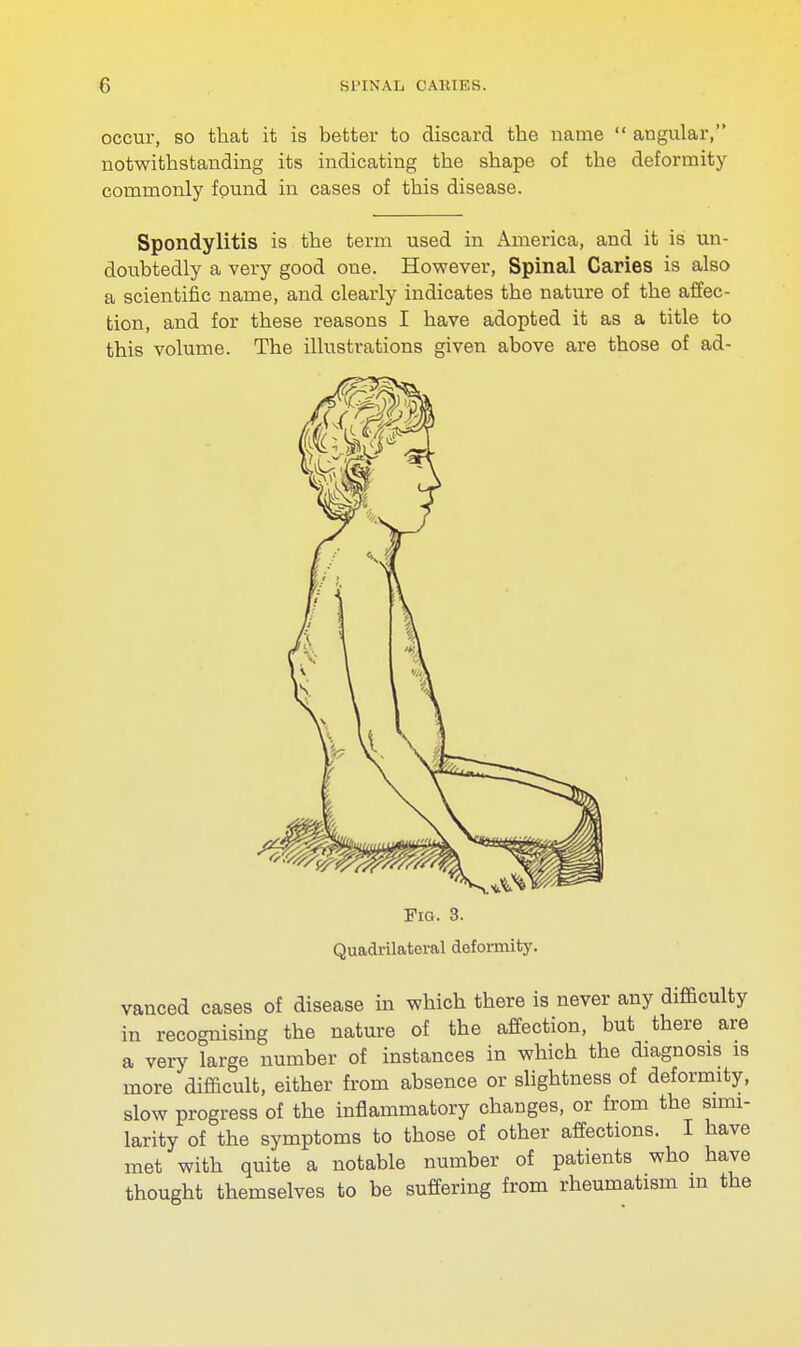 occur, so that it is better to discard the name  angular, notwithstanding its indicating the shape of the deformity commonly found in cases of this disease. Spondylitis is the term used in America, and it is un- doubtedly a very good one. However, Spinal Caries is also a scientific name, and clearly indicates the nature of the affec- tion, and for these reasons I have adopted it as a title to this volume. The illustrations given above are those of ad- Fig. 3. Quadrilateral deformity. vanced cases of disease in which there is never any difficulty in recognising the nature of the affection, but there are a very large number of instances in which the diagnosis is more difficult, either from absence or slightness of deformity, slow progress of the inflammatory changes, or from the simi- larity of the symptoms to those of other affections. I have met with quite a notable number of patients who have thought themselves to be suffering from rheumatism m the