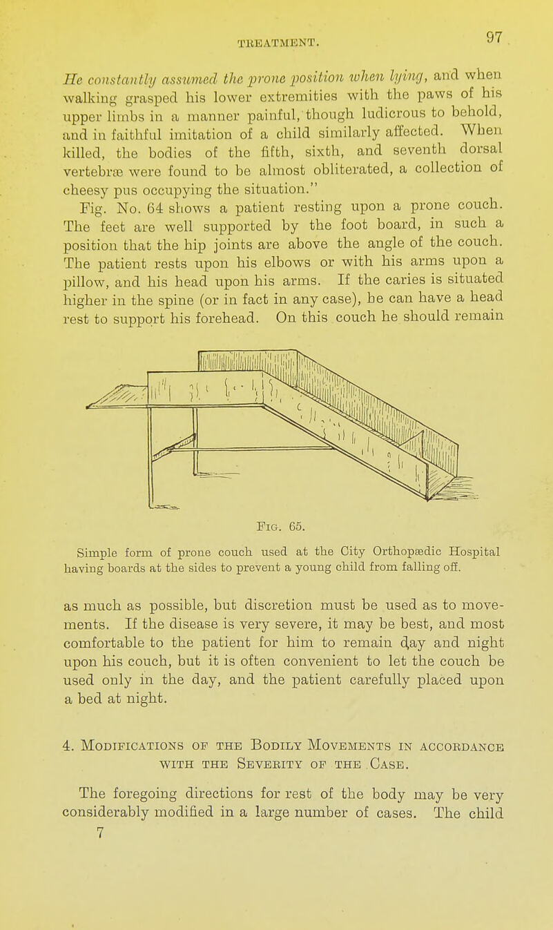 He constantly assumed the prone position when Vymg, and when walking grasped his lower extremities with the paws of his upper limbs in a manner painful, though ludicrous to behold, and in faithful imitation of a child similarly affected. When killed, the bodies of the fifth, sixth, and seventh dorsal vertebra? were found to be almost obliterated, a collection of cheesy pus occupying the situation. Fig. No. 64 shows a patient resting upon a prone couch. The feet are well supported by the foot board, in such a position that the hip joints are above the angle of the couch. The patient rests upon his elbows or with his arms upon a pillow, and his head upon his arms. If the caries is situated higher in the spine (or in fact in any case), he can have a head rest to support his forehead. On this couch he should remain Pig. 65. Simple form of prone couch used at the City Orthopasdic Hospital having boards at the sides to prevent a young child from falling off. as much as possible, but discretion must be used as to move- ments. If the disease is very severe, it may be best, and most comfortable to the patient for him to remain clay and night upon his couch, but it is often convenient to let the couch be used only in the day, and the patient carefully placed upon a bed at night. 4. Modifications of the Bodily Movements in accordance with the Severity of the Case. The foregoing directions for rest of the body may be very considerably modified in a large number of cases. The child 7