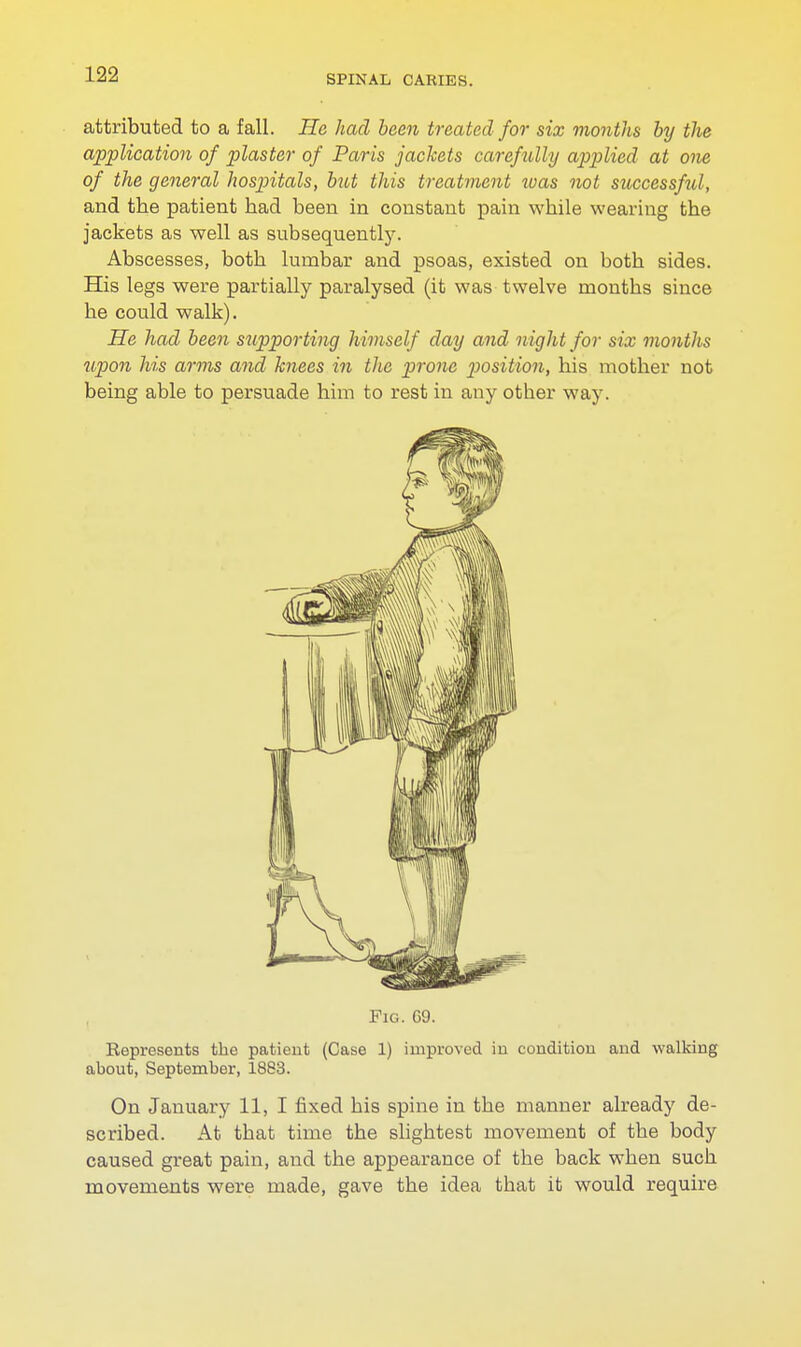 attributed to a fall. He had been treated for six months by the application of plaster of Paris jackets carefully applied at one of the general hospitals, but this treatment tvas not successful, and the patient had been in constant pain while wearing the jackets as well as subsequently. Abscesses, both lumbar and psoas, existed on both sides. His legs were partially paralysed (it was twelve months since he could walk). He had been supporting himself day and night for six months upon his arms and knees in the prone jiosition, his mother not being able to persuade him to rest in any other way. Fig. G9. Represents the patient (Case 1) improved in condition and walking about, September, 1883. On January 11, I fixed bis spine in the manner already de- scribed. At tbat time the slightest movement of the body caused great pain, and the appearance of the back when such movements were made, gave the idea that it would require